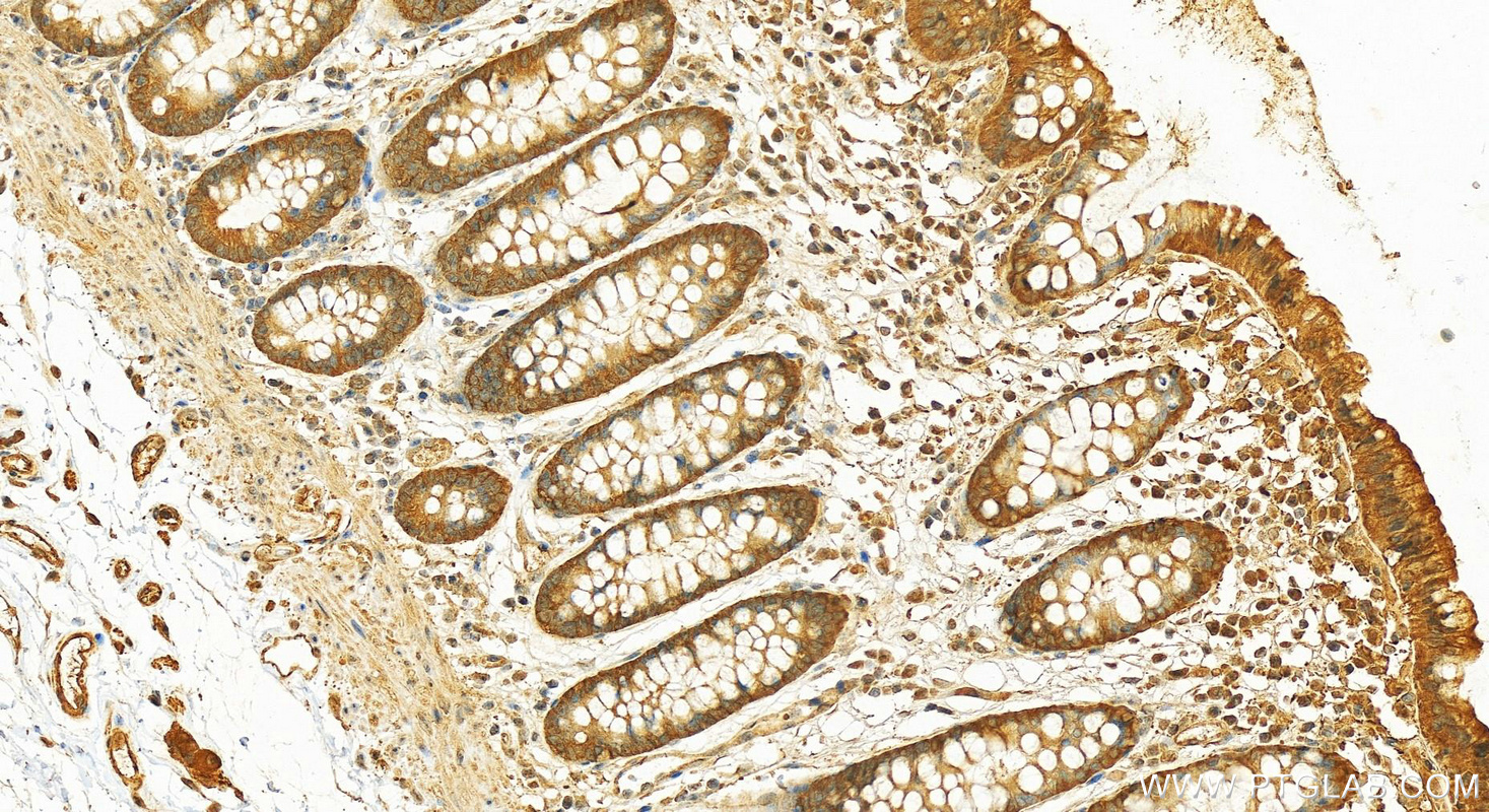 Immunohistochemistry (IHC) staining of human colon tissue using HSP90 Polyclonal antibody (13171-1-AP)