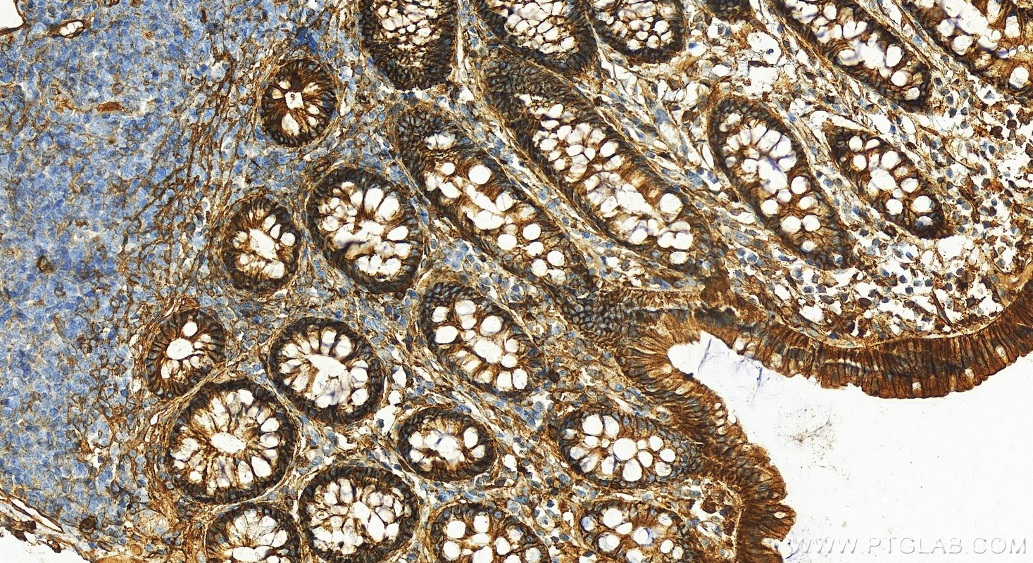 Immunohistochemistry (IHC) staining of human colon tissue using HSP90 Polyclonal antibody (13171-1-AP)