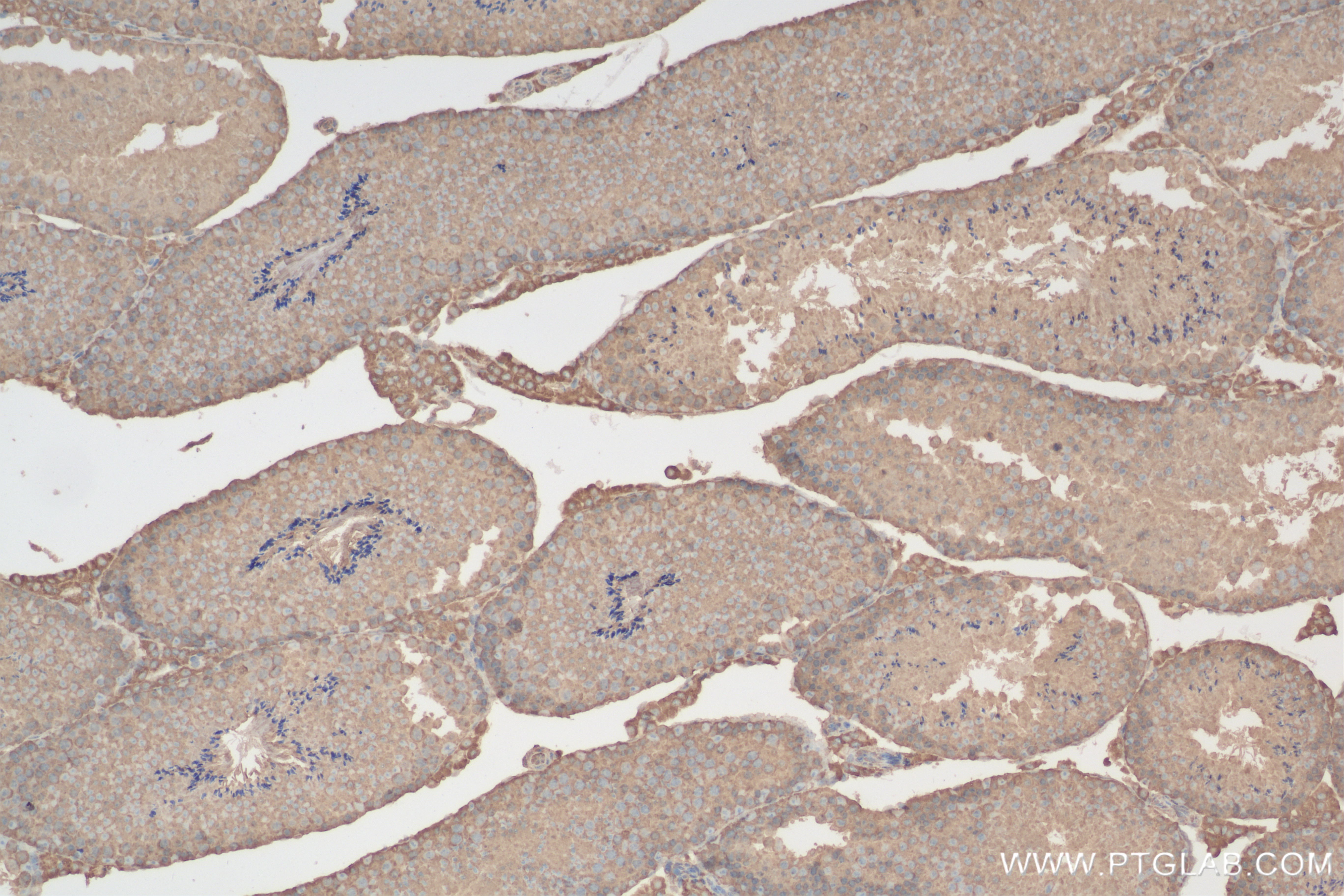 Immunohistochemistry (IHC) staining of mouse testis tissue using HSP90 Recombinant antibody (83950-5-RR)