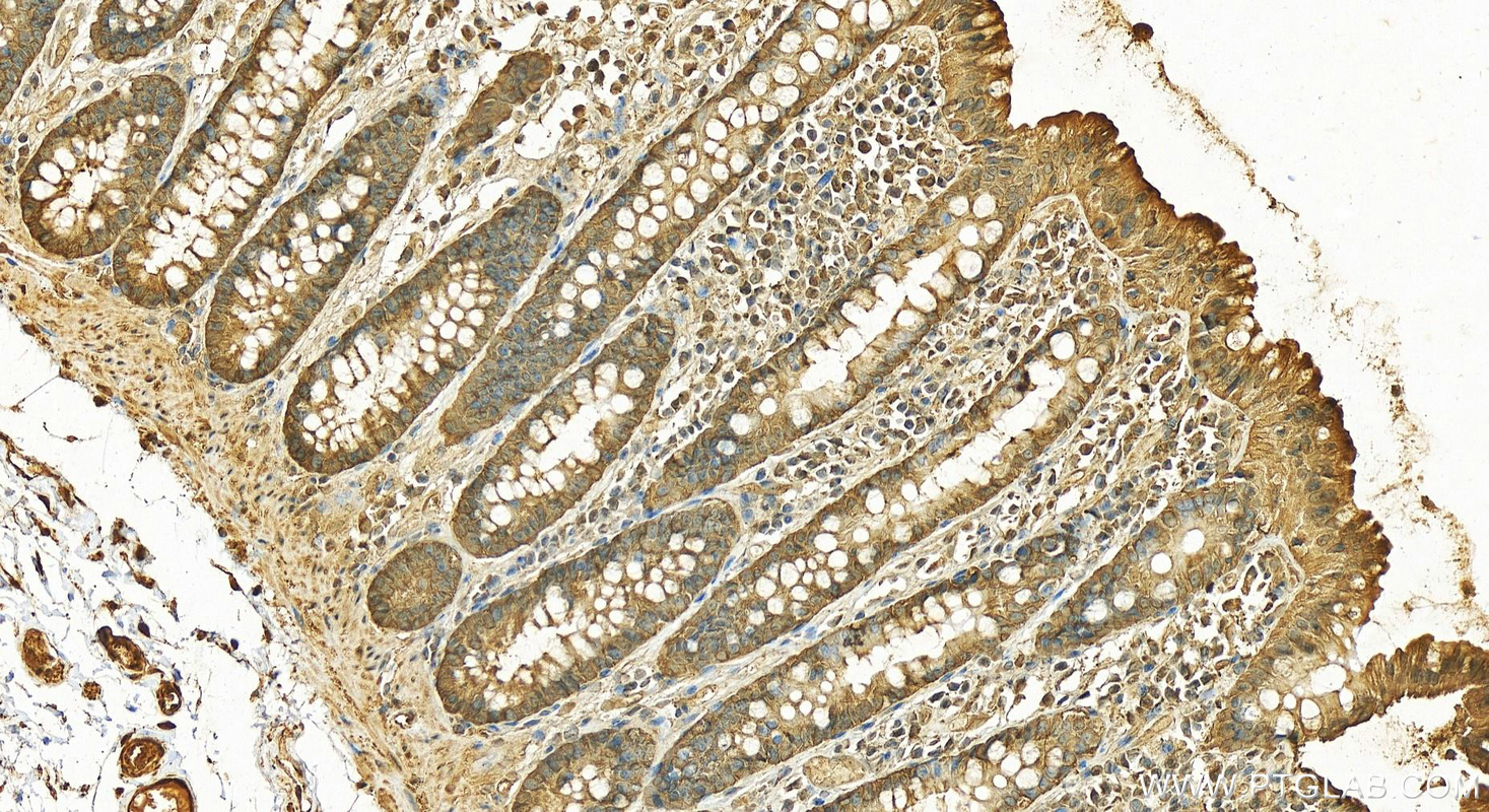 Immunohistochemistry (IHC) staining of human colon tissue using HSP90AB1 Polyclonal antibody (11405-1-AP)