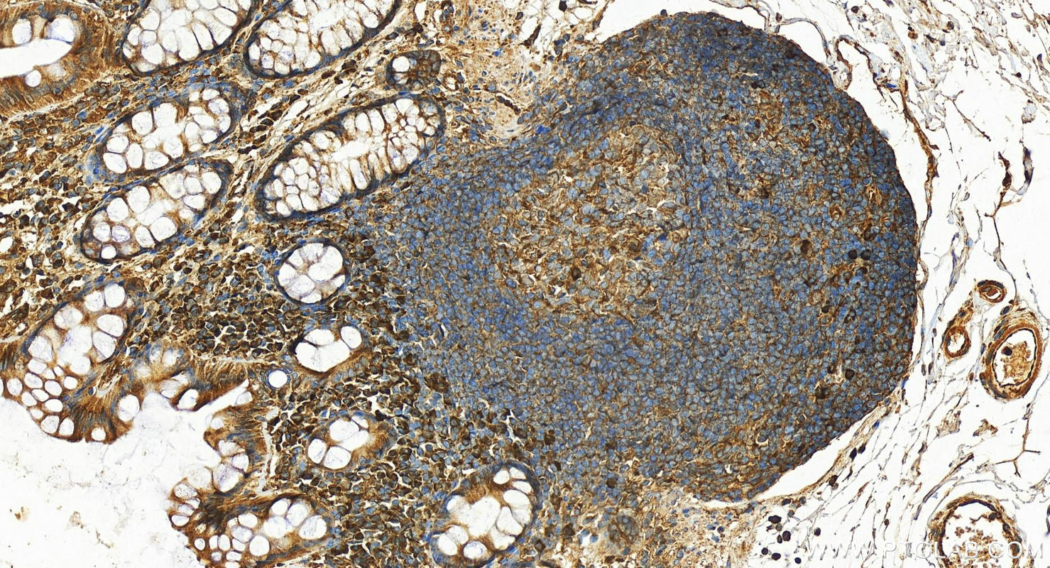 Immunohistochemistry (IHC) staining of human colon tissue using GRP94 Polyclonal antibody (10979-1-AP)