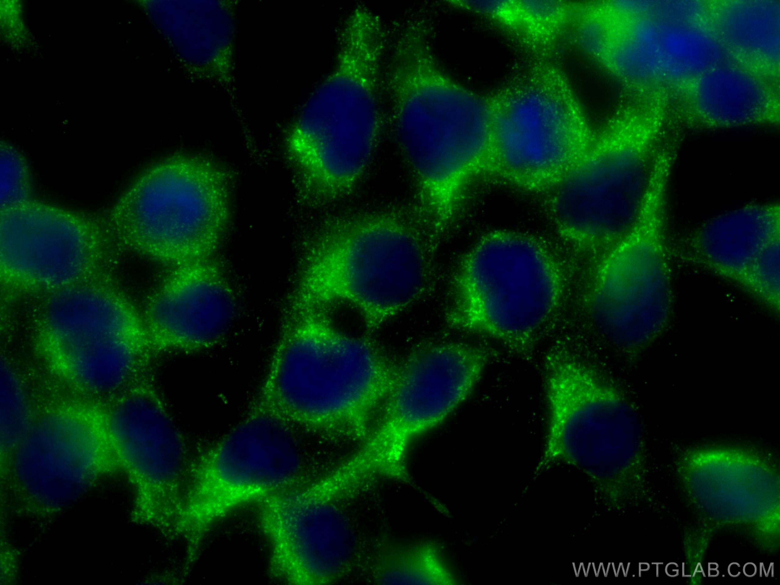 Immunofluorescence (IF) / fluorescent staining of HEK-293 cells using GRP94 Polyclonal antibody (10979-1-AP)