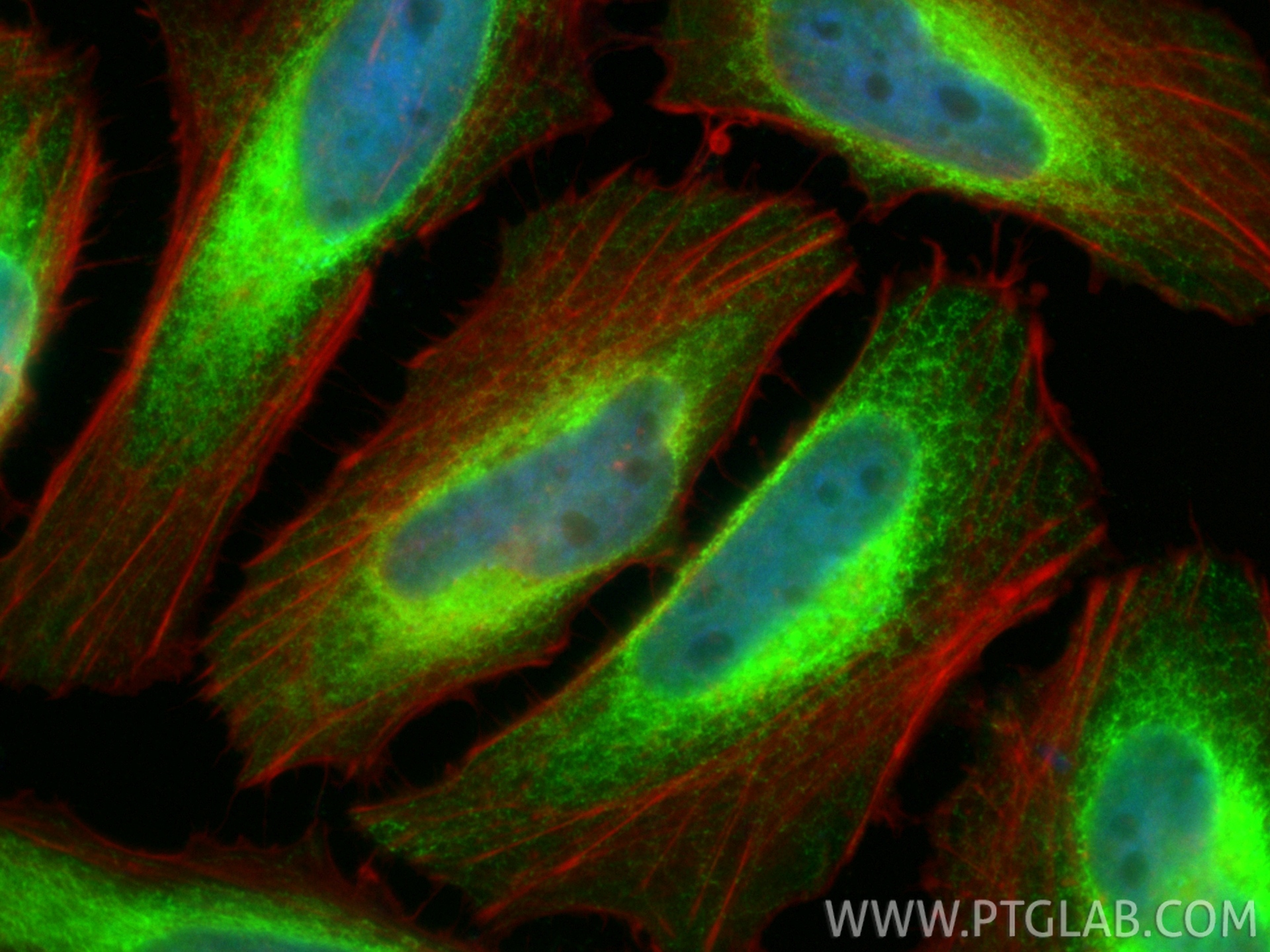 Immunofluorescence (IF) / fluorescent staining of HeLa cells using GRP94 Polyclonal antibody (14700-1-AP)