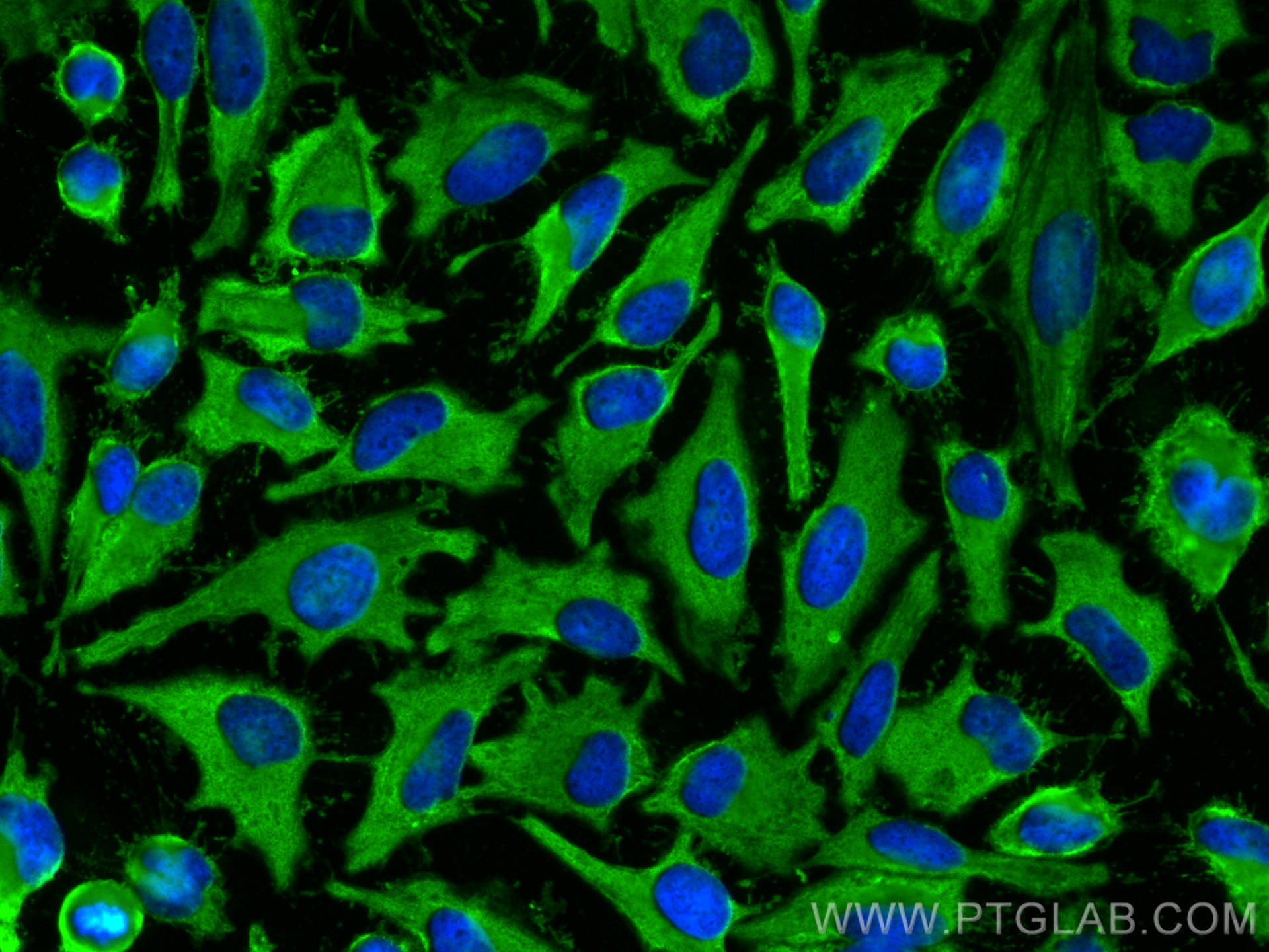 Immunofluorescence (IF) / fluorescent staining of HeLa cells using HSP70 Polyclonal antibody (10995-1-AP)