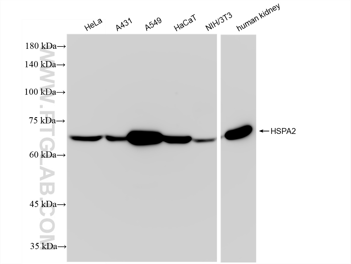 Western Blot (WB) analysis of various lysates using HSPA2 Recombinant antibody (83466-1-RR)