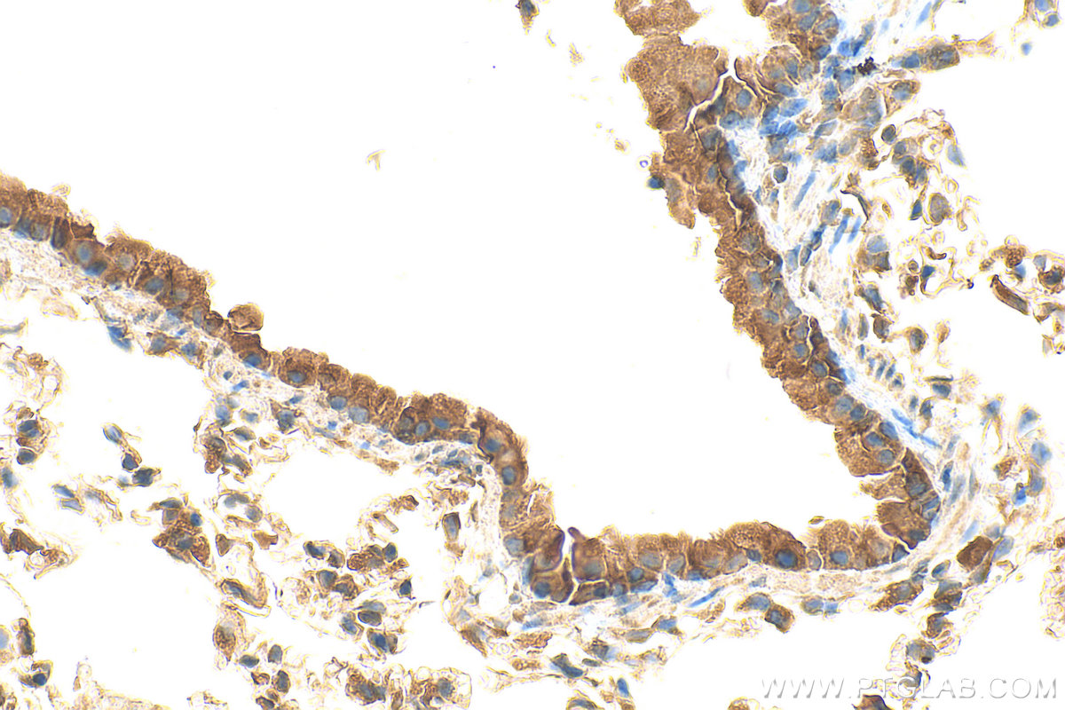 Immunohistochemistry (IHC) staining of mouse lung tissue using HSPA6 Polyclonal antibody (13616-1-AP)