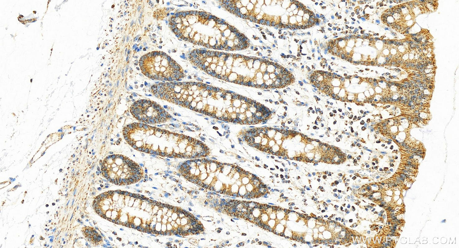 Immunohistochemistry (IHC) staining of human normal colon using GRP75 Polyclonal antibody (14887-1-AP)