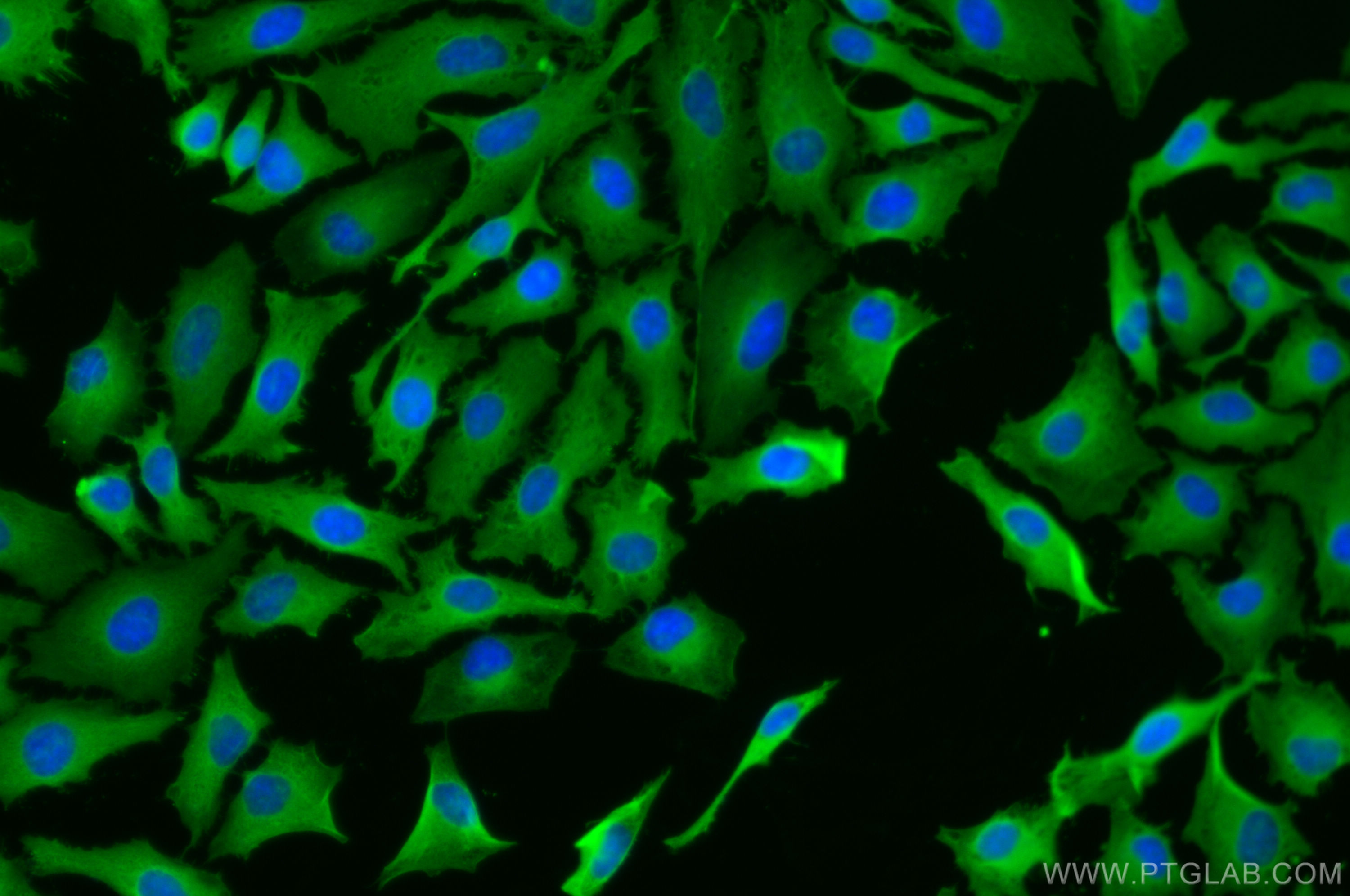 Immunofluorescence (IF) / fluorescent staining of HeLa cells using HSP27 Polyclonal antibody (18284-1-AP)