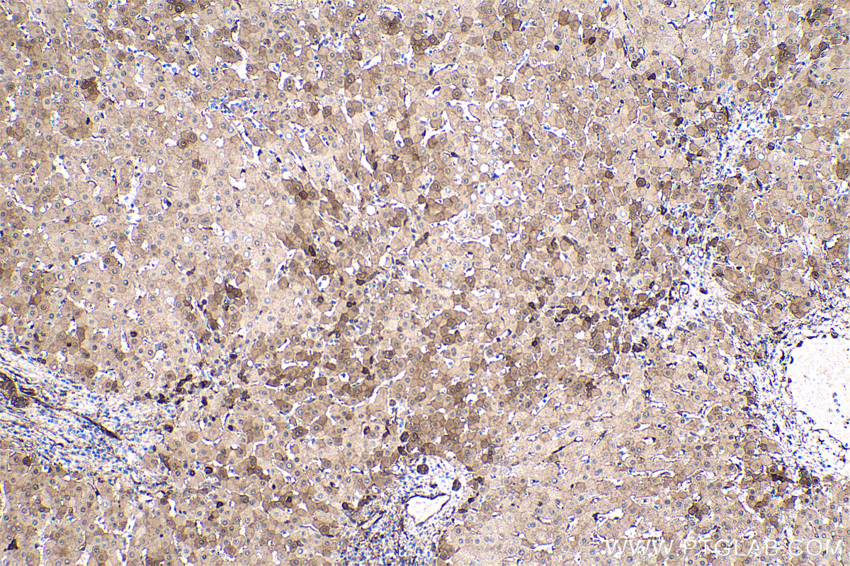 Immunohistochemistry (IHC) staining of human liver tissue using HSP27 Monoclonal antibody (66767-1-Ig)