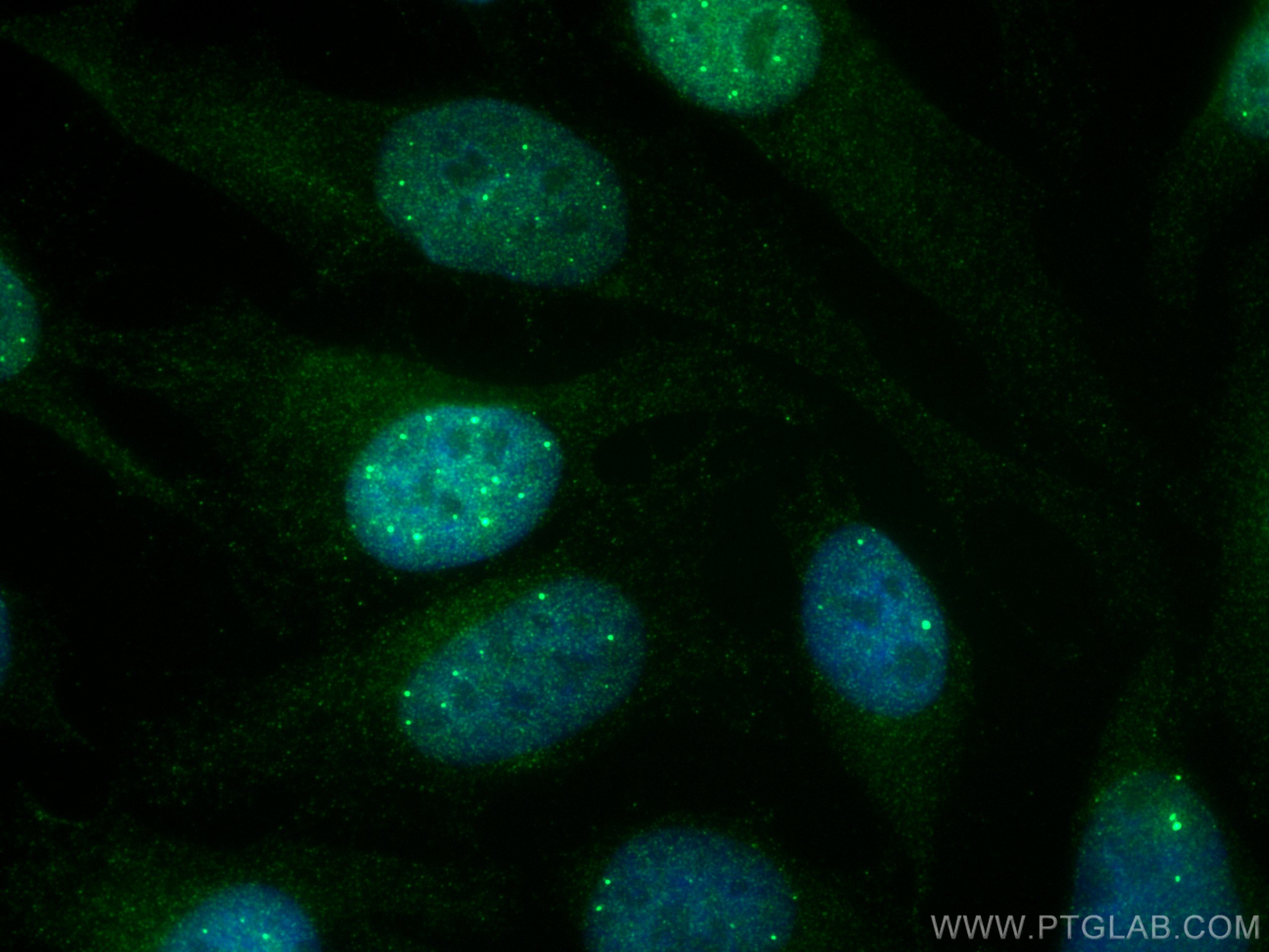HSPB3 antibody (67890-1-Ig) | Proteintech