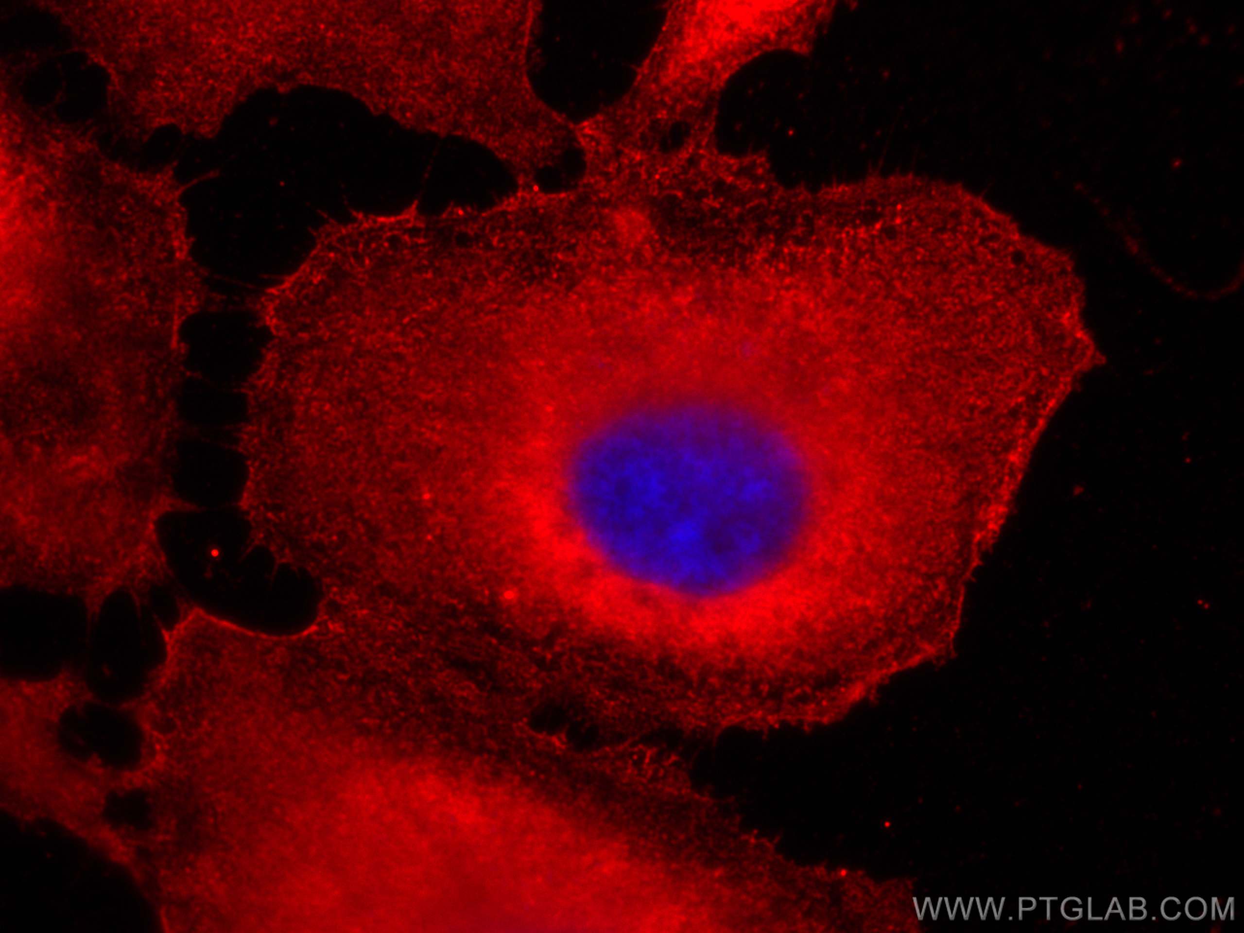 Immunofluorescence (IF) / fluorescent staining of HeLa cells using CoraLite®594-conjugated HSPH1 Monoclonal antibody (CL594-66723)