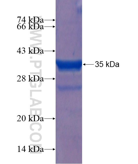 HSV-S1-NanO-MAT-VSV-V5 tag fusion protein Ag21970 SDS-PAGE