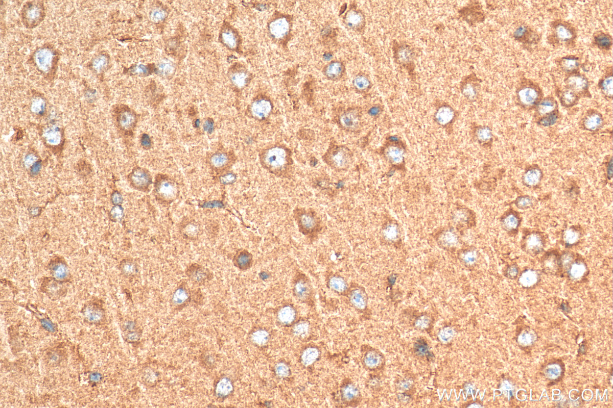 Immunohistochemistry (IHC) staining of mouse brain tissue using HTR7 Polyclonal antibody (29238-1-AP)