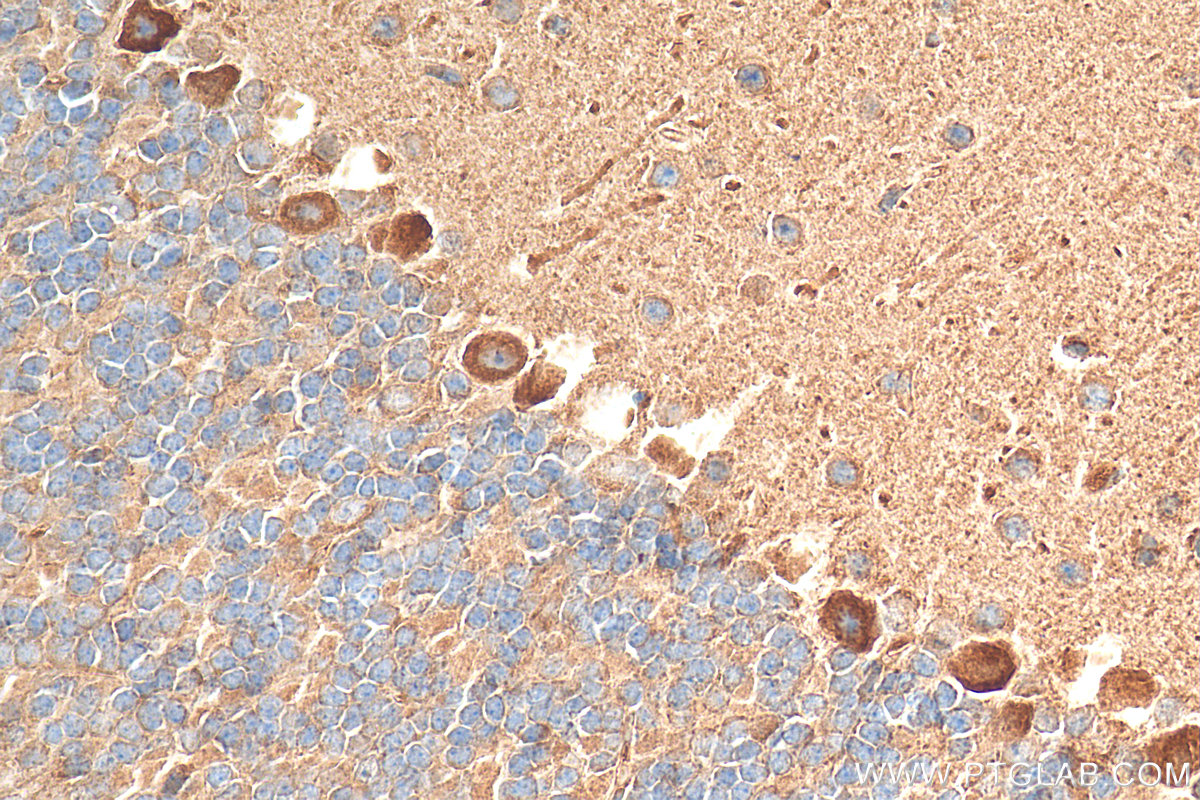 Immunohistochemistry (IHC) staining of mouse cerebellum tissue using HTR7 Polyclonal antibody (29238-1-AP)