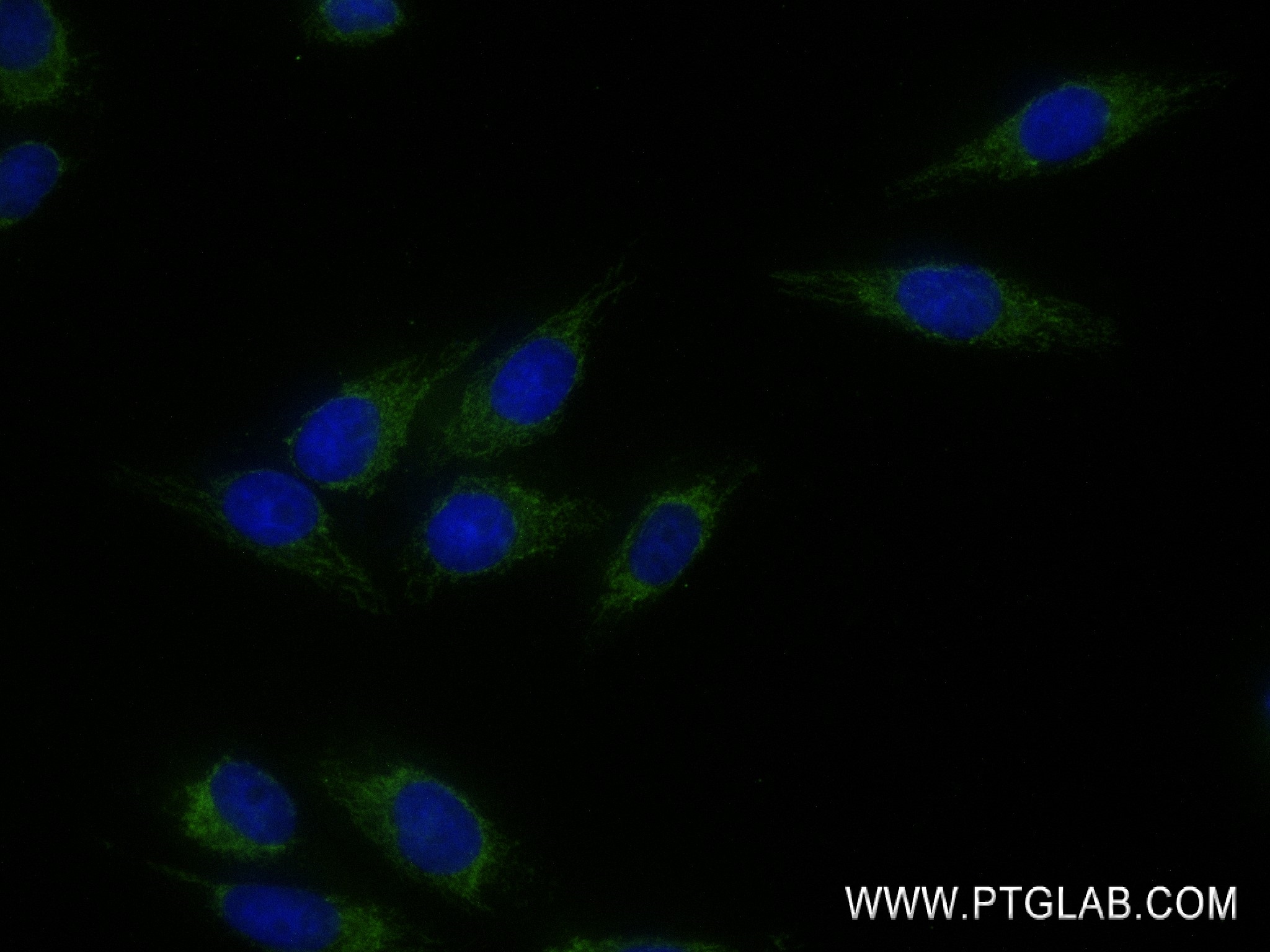 Immunofluorescence (IF) / fluorescent staining of HepG2 cells using HTRA2 Recombinant antibody (83492-7-RR)