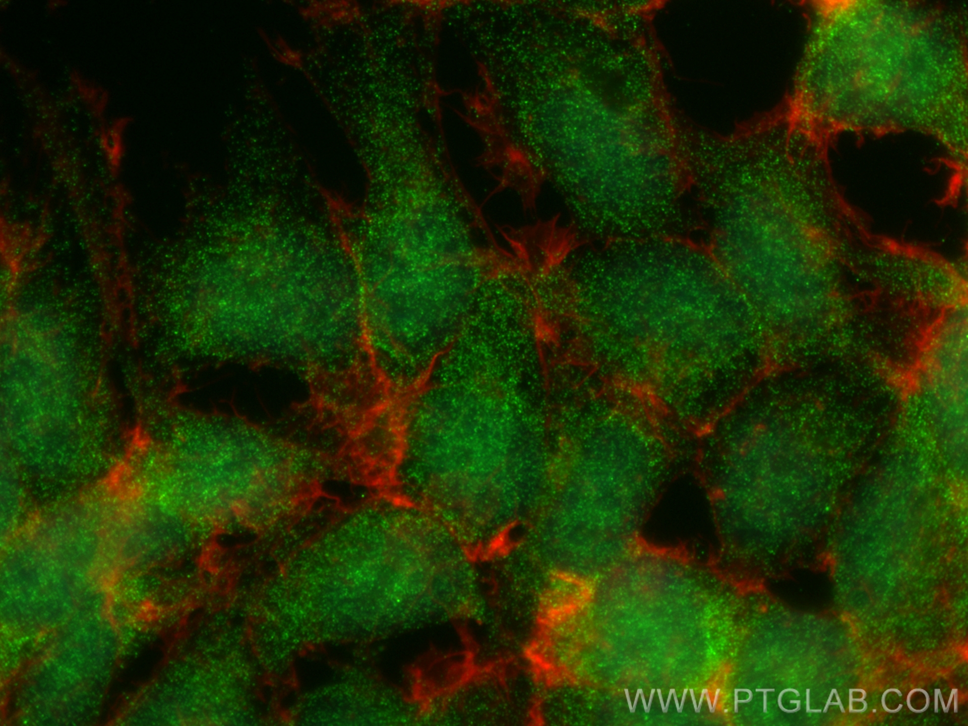 Immunofluorescence (IF) / fluorescent staining of HEK-293 cells using Huntingtin Polyclonal antibody (19957-1-AP)