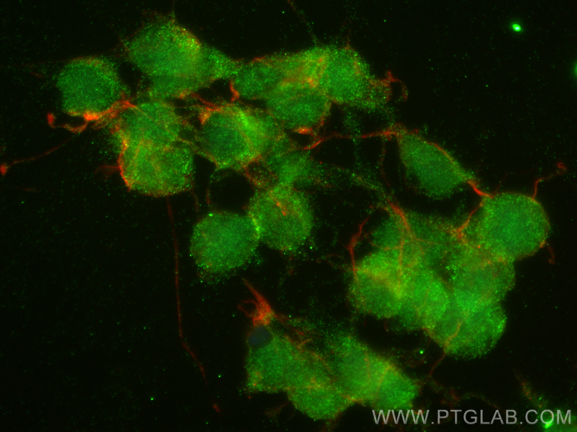 Immunofluorescence (IF) / fluorescent staining of SH-SY5Y cells using Huntingtin Polyclonal antibody (19957-1-AP)