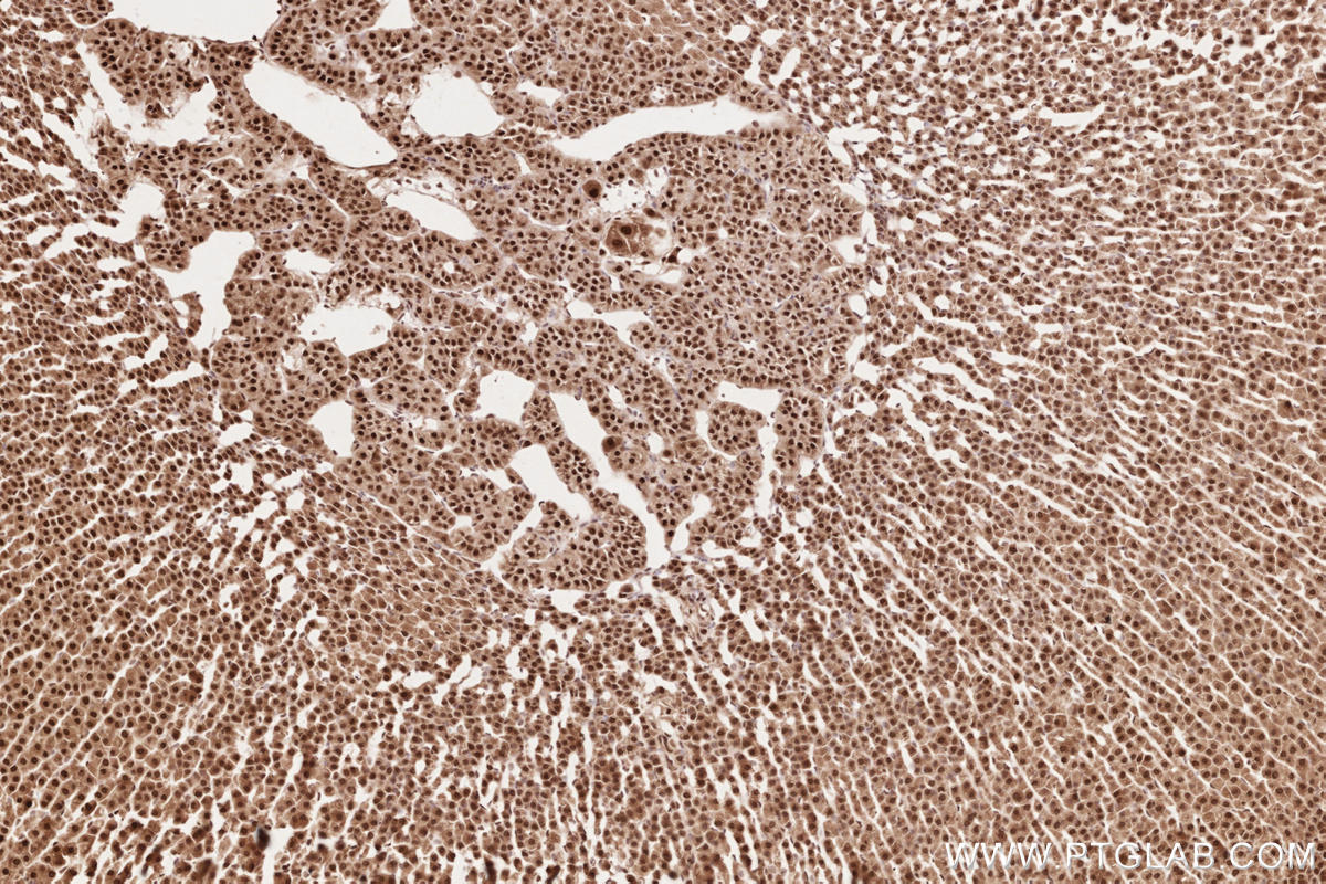 Immunohistochemistry (IHC) staining of rat adrenal gland tissue using HUWE1 Polyclonal antibody (19430-1-AP)