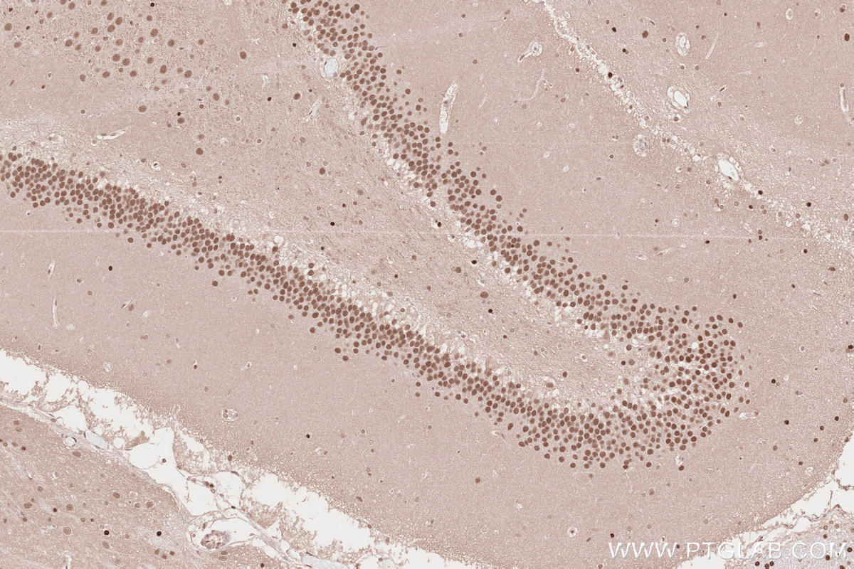 Immunohistochemistry (IHC) staining of rat brain tissue using HUWE1 Polyclonal antibody (19430-1-AP)