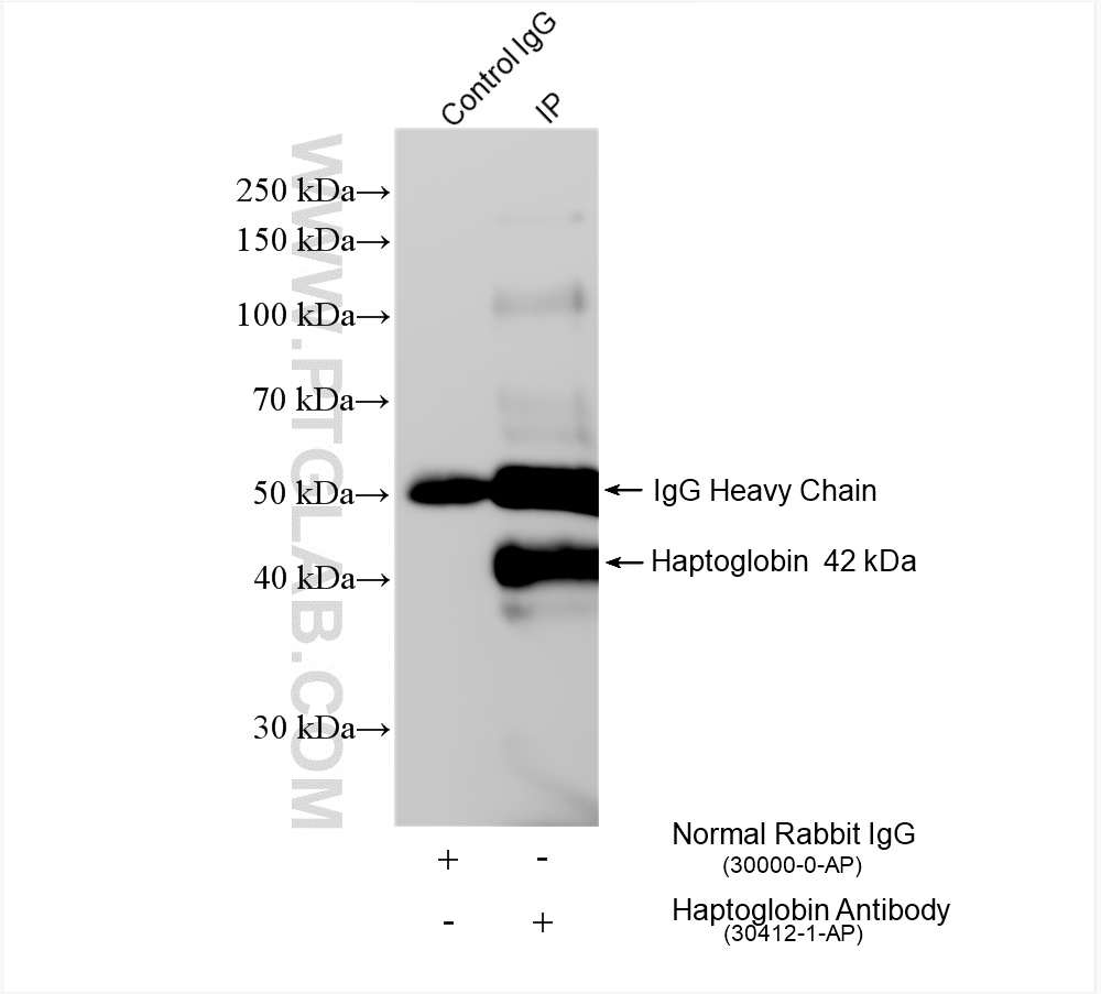 Immunoprecipitation (IP) experiment of human plasma using Haptoglobin Polyclonal antibody (30412-1-AP)