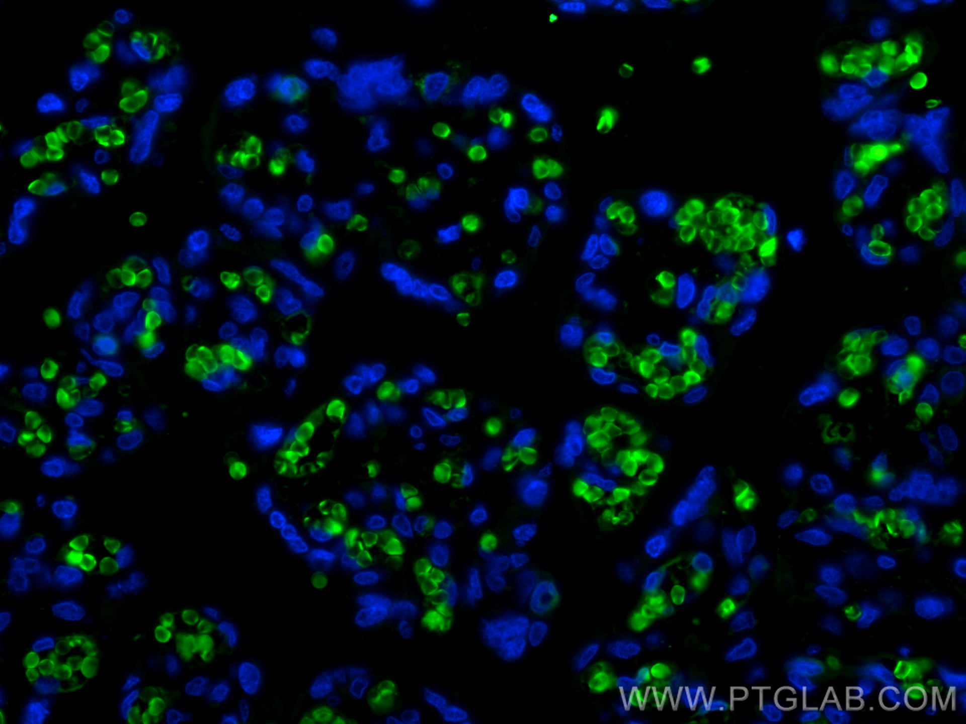 Immunofluorescence (IF) / fluorescent staining of human placenta tissue using CoraLite® Plus 488-conjugated Hemoglobin Epsilon P (CL488-12361)
