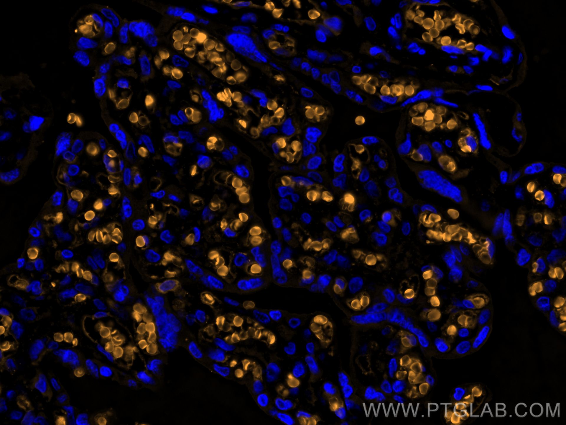Immunofluorescence (IF) / fluorescent staining of human placenta tissue using CoraLite®555-conjugated Hemoglobin Epsilon Polyclo (CL555-12361)