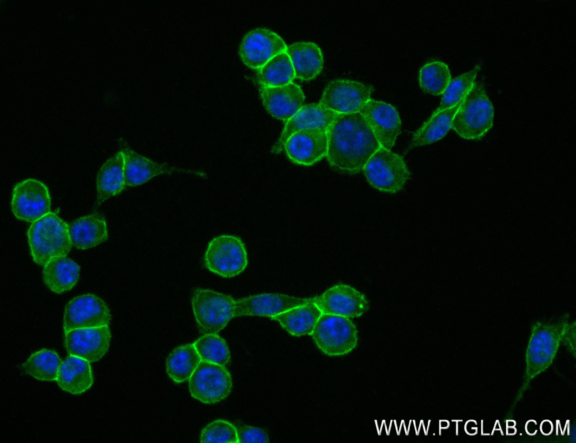 Immunofluorescence (IF) / fluorescent staining of 4T1 cells using Her2 / ErbB2 Recombinant antibody (84128-5-RR)