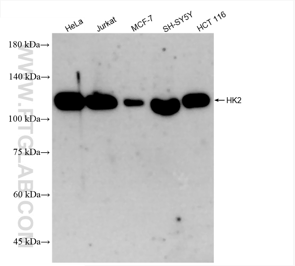 Western Blot (WB) analysis of various lysates using Hexokinase 2 Recombinant antibody (85875-1-RR)