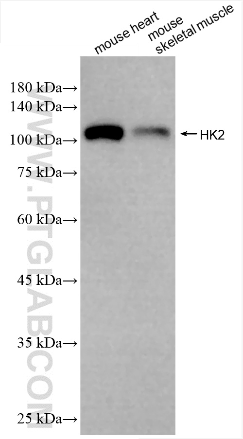 Western Blot (WB) analysis of various lysates using Hexokinase 2 Recombinant antibody (85875-1-RR)