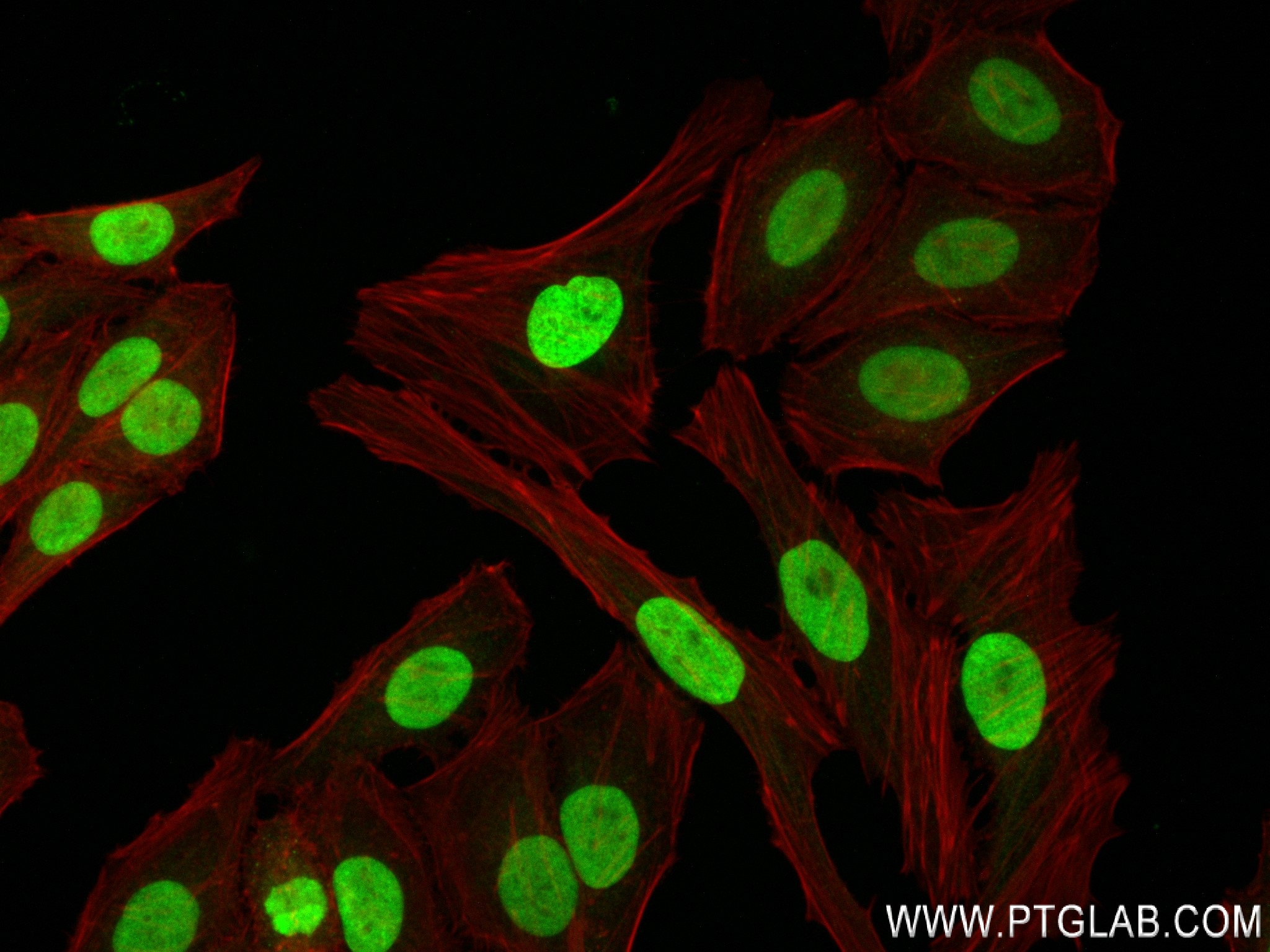 Immunofluorescence (IF) / fluorescent staining of HepG2 cells using Histone H1.0 Recombinant antibody (83993-4-RR)