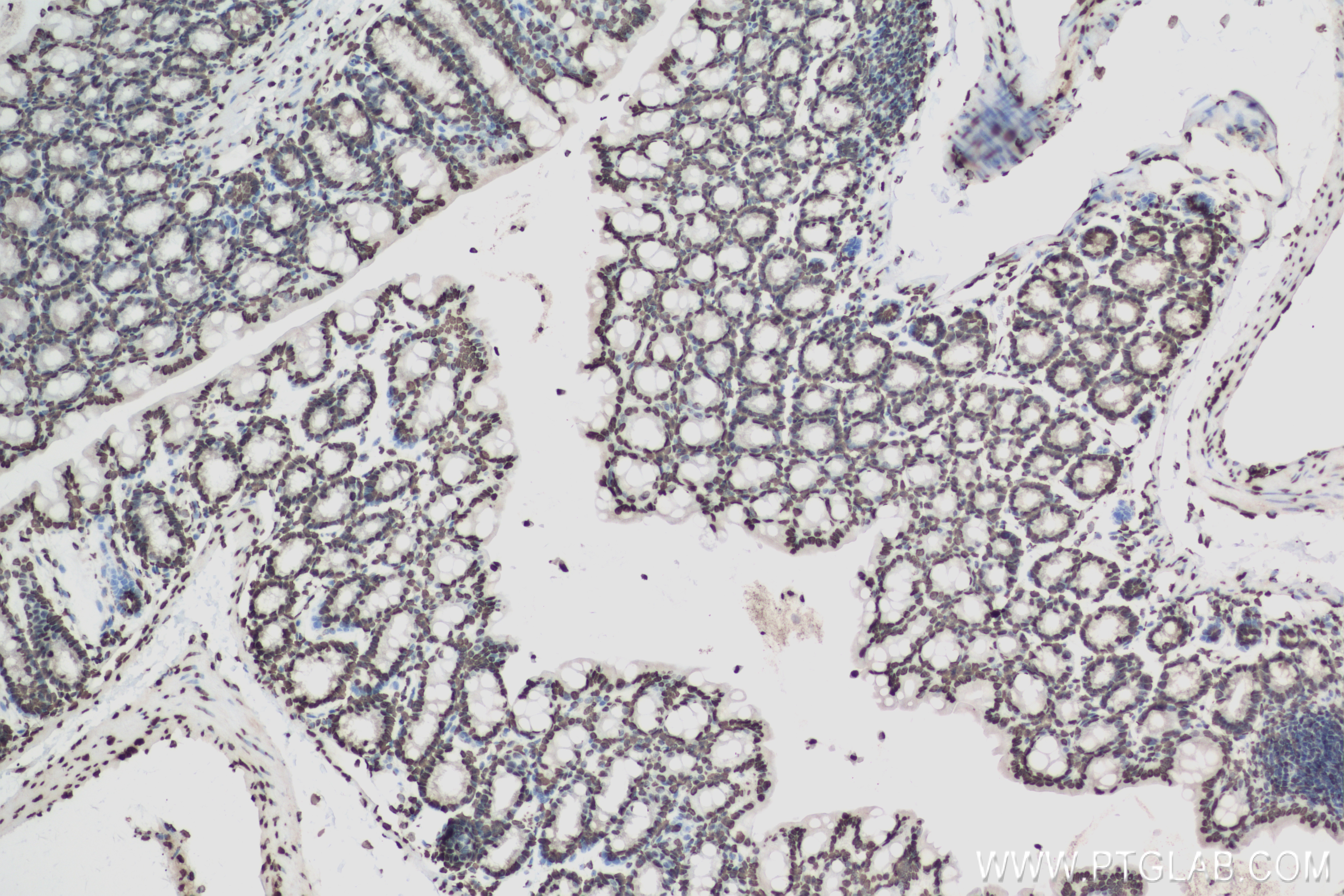 Immunohistochemistry (IHC) staining of mouse colon tissue using Histone H1.0 Recombinant antibody (83993-4-RR)