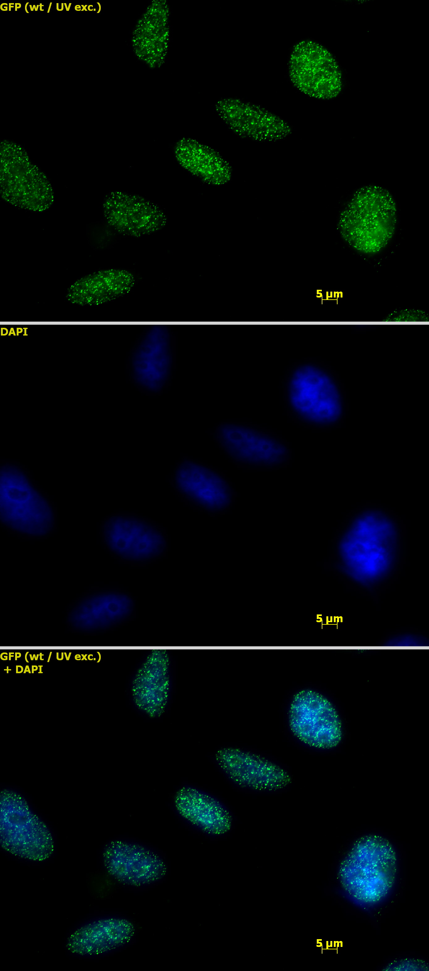 Histone H1 antibody tested by immunofluorescence. Detection of Histone H1 by immunofluorescence. HeLa cells were stained with Histone H1 antibody at a dilution of 1:1,000. Top panel: Histone H1 antibody staining. Middle panel: DAPI. Bottom panel: merge.