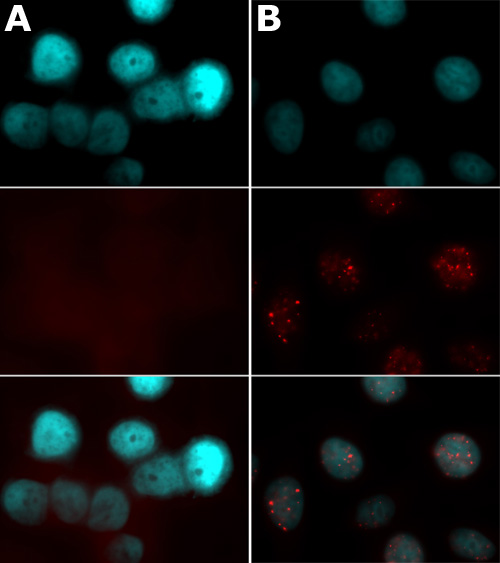 Histone H2AX phospho Ser139 antibody tested by immunofluorescence. HeLa cells stained with Histone H2AX phospho Ser139 antibody (1:500 dilution) using MAX Stain Immunofluorescence Tools. The HeLa cells were blocked with MAXblock Blocking Medium and stained with Histone H2AX phospho Ser139 antibody. Panel A: Untreated HeLa cells. Panel B: Cells fixed and stained 90 minutes after 3 Gy ionizing radiation treatment. Top images: Cells were stained with DAPI. Middle images: Same cells stained with Histone H2AX phospho Ser139 antibody. Bottom images: Merge of both images above. Images were made using Zeiss Axiovision with equivalent acquisition settings for direct comparison. Note Panel B-middle image, which shows intense nuclear clustering of ionizing radiation-induced phosphorylation of Ser139 of H2AX. In contrast, Panel A-middle image shows no detectable phosphorylated H2AX.