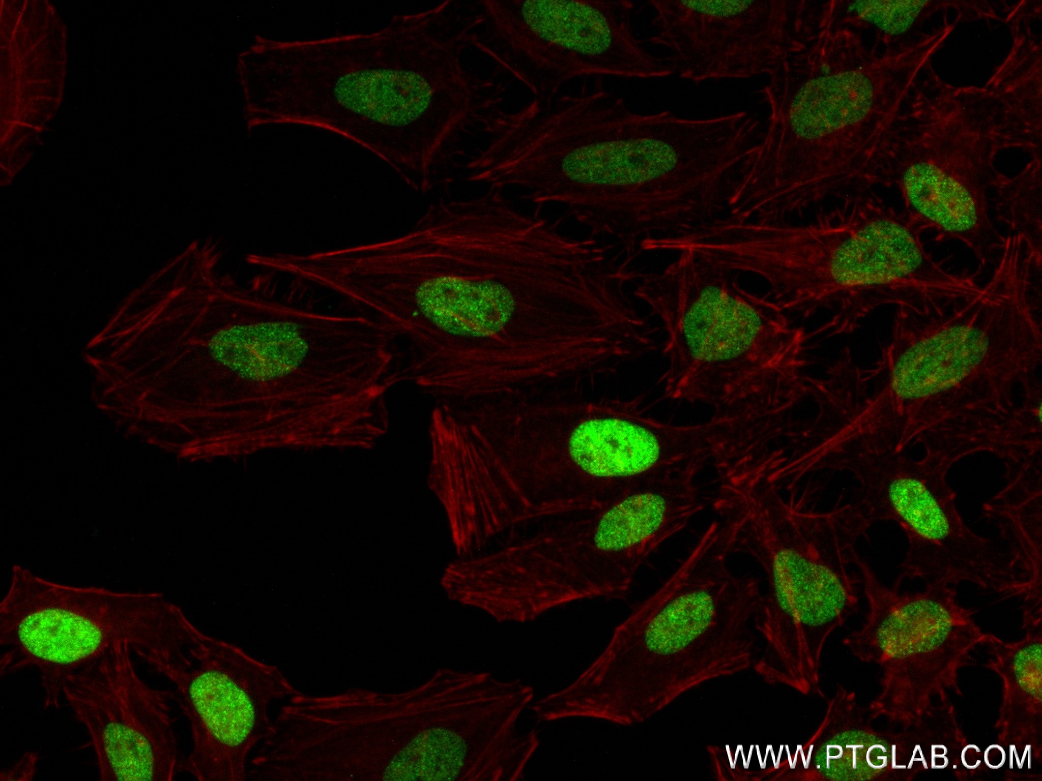 Immunofluorescence (IF) / fluorescent staining of HeLa cells using Histone H3 Recombinant antibody (81984-2-RR)