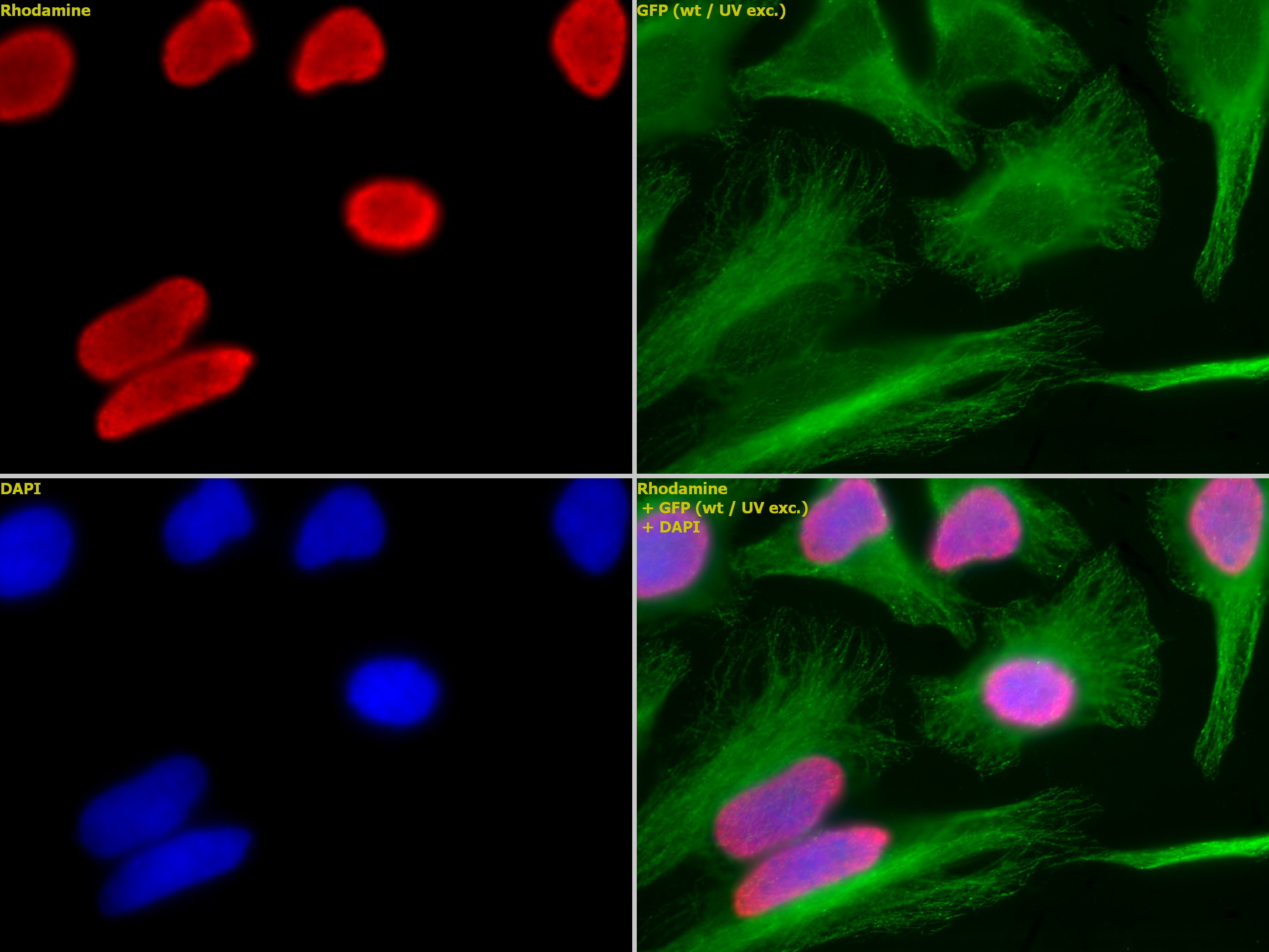 Histone H3 acetyl Lys18 antibody tested by immunofluorescence. Top left: HeLa cells stained with Histone H3 acetyl Lys18 antibody (1:1,000). Top right: Same cells stained with alpha Tubulin mAb (Clone 5-B-1-2). Bottom left: Stained with DAPI. Bottom right: Merge of all 3 images.