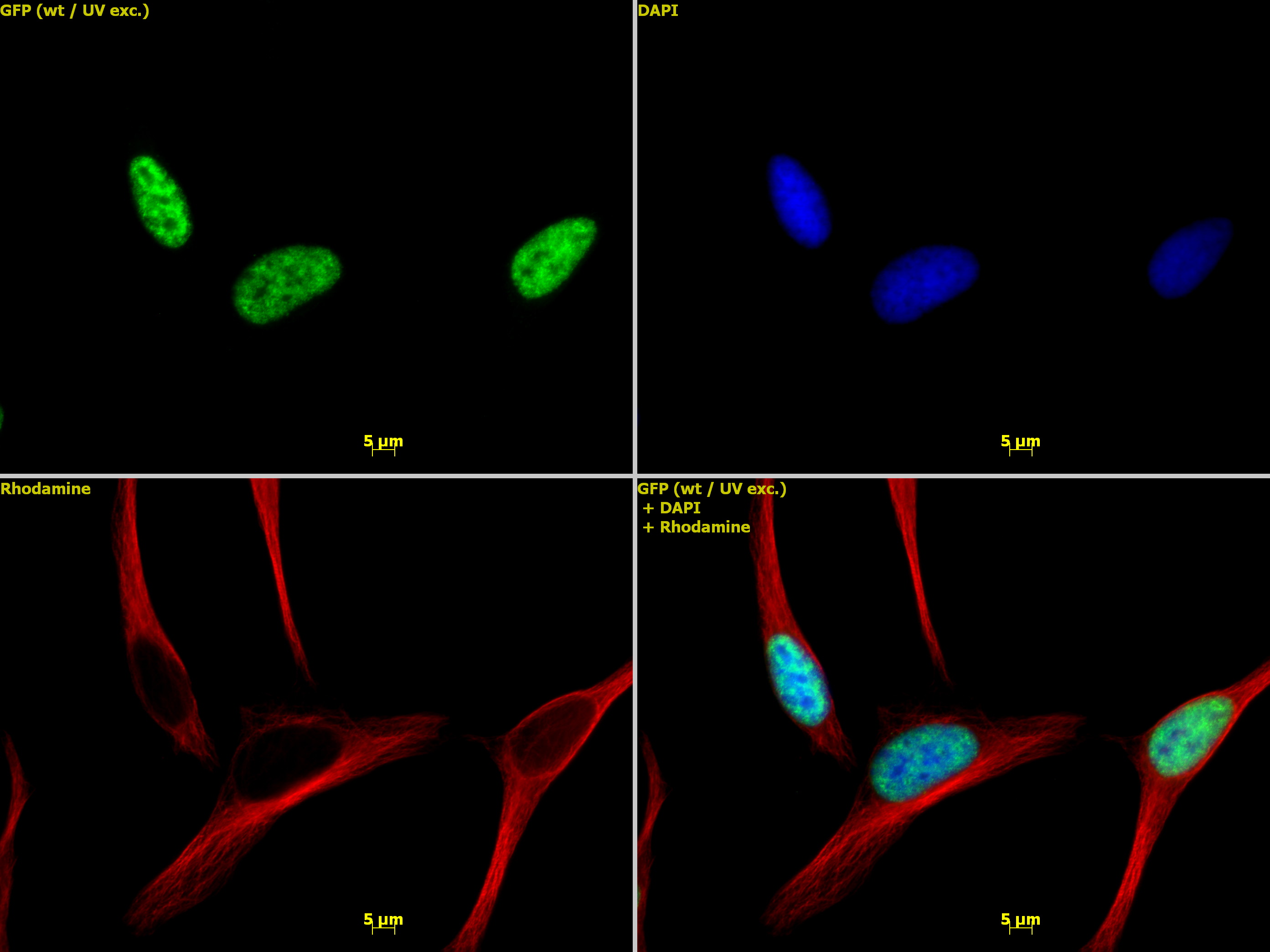 Histone H3 trimethyl Lys4 antibody tested by immunofluorescence. HeLa cells stained at 1:1,000 with Histone H3 trimethyl Lys4 antibody. Top left: Histone H3 trimethyl Lys4 antibody.Top right: Stained with DAPI. Bottom left: Same cells stained with alpha Tubulin mAb (Clone 5-B-1-2). Bottom right: Merge of all 3 images.