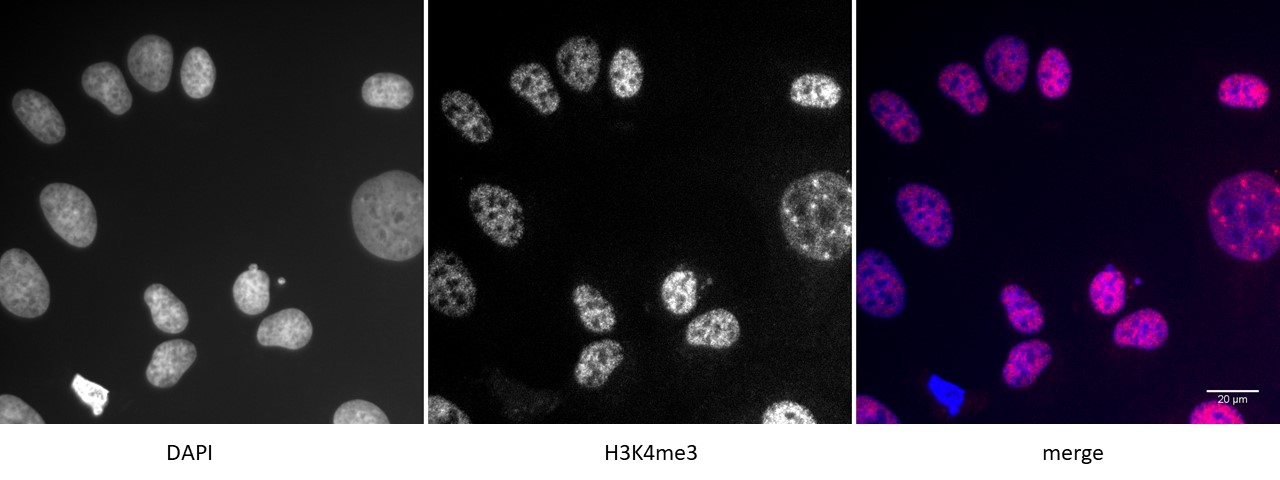 Detection of H3K4me3 by immunofluorescence U2OS cells were stained with H3K4me3 antibody at a dilution of 1:500. Left panel: DAPI. Middle panel: H3K4me3 antibody staining Right panel: merge.