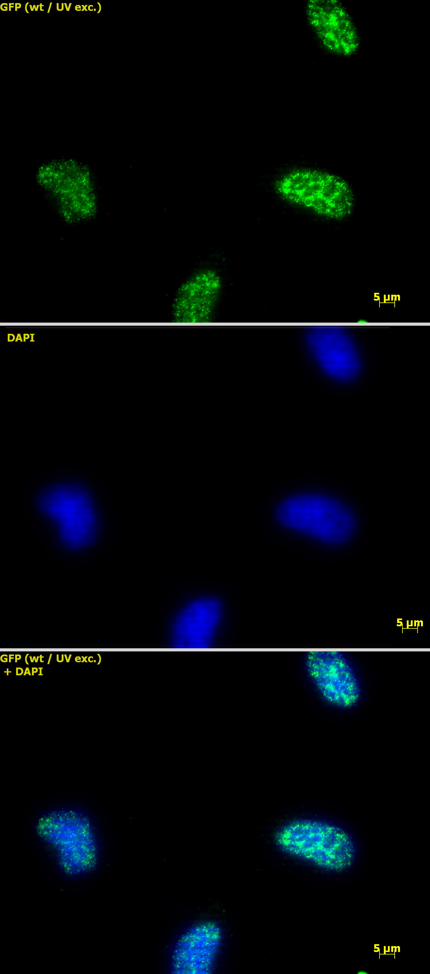 Immunofluorescence stain of Histone H3K9ac antibody (pAb). HeLa cells stained at 2 ug/ml with Histone H3 acetyl Lys9 antibody. Top panel: Histone H3 acetyl Lys9 antibody. Middle panel: DAPI. Bottom panel: merge.