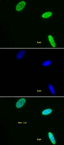 Histone H3K9me2 antibody tested by immunofluorescence. Staining of HeLa cells with Histone H3K9me2 antibody (1:1,000 dilution, top panel) and DAPI (middle panel), and a merge of both images (bottom panel).