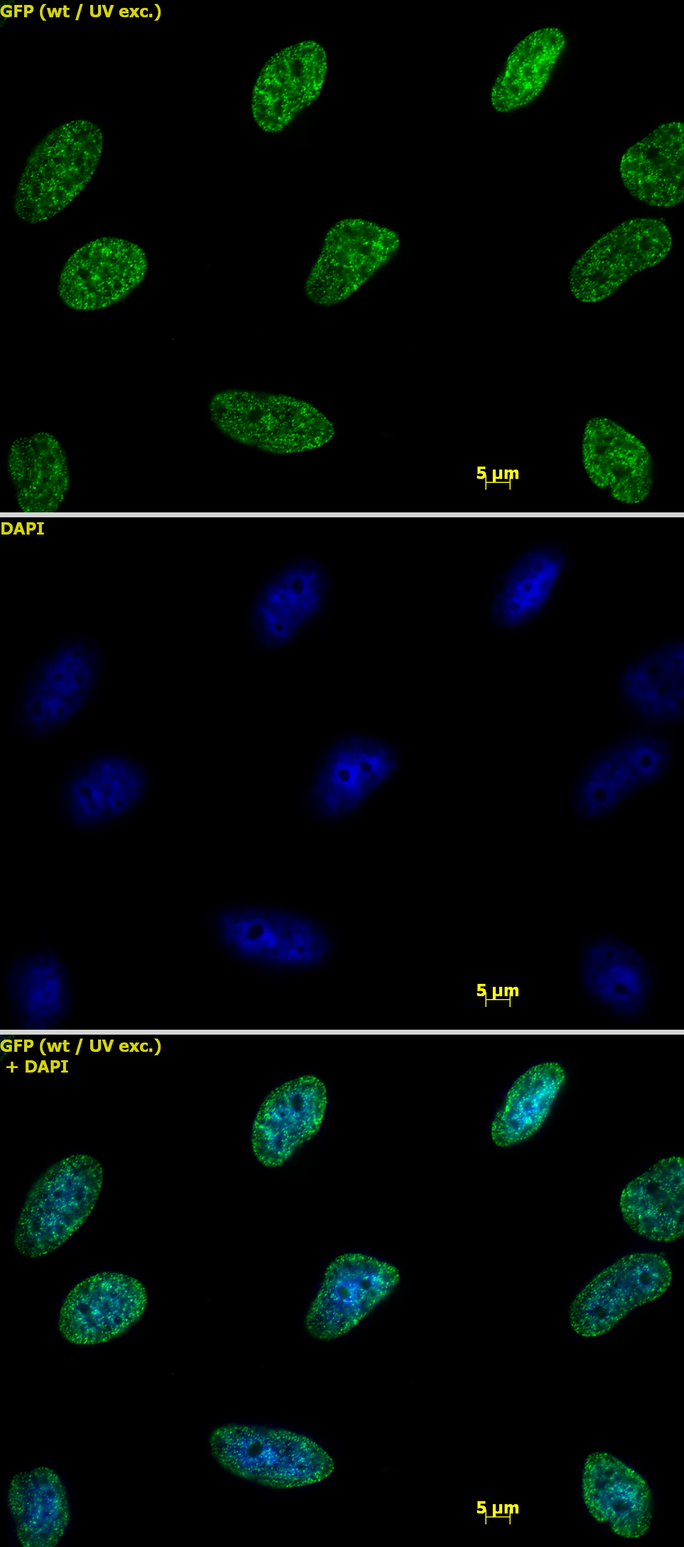 Histone H3 dimethyl Lys9 antibody tested by immunofluorescence. Detection of Histone H3 dimethyl Lys9 by immunofluorescence. HeLa cells were stained with Histone H3 dimethyl Lys9 antibody at a dilution of 1 ug/ml. Top panel: Histone H3 dimethyl Lys9 antibody staining. Middle panel: DAPI. Bottom panel: merge.