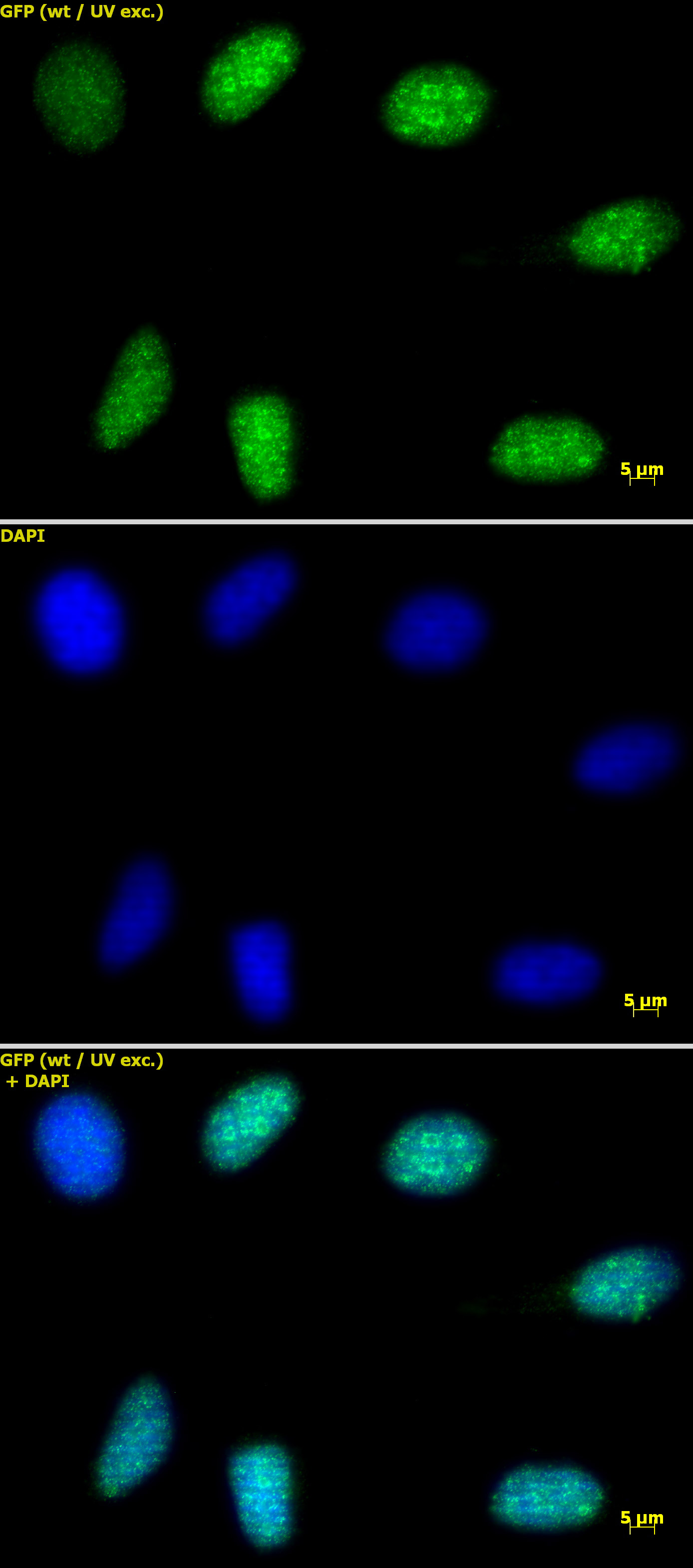 Histone H3 trimethyl Lys9 antibody tested by immunofluorescence. HeLa cells stained at 2 ug/ml with Histone H3 trimethyl Lys9 antibody. Top panel: Histone H3 trimethyl Lys9 antibody. Middle panel: DAPI. Bottom panel: merge.