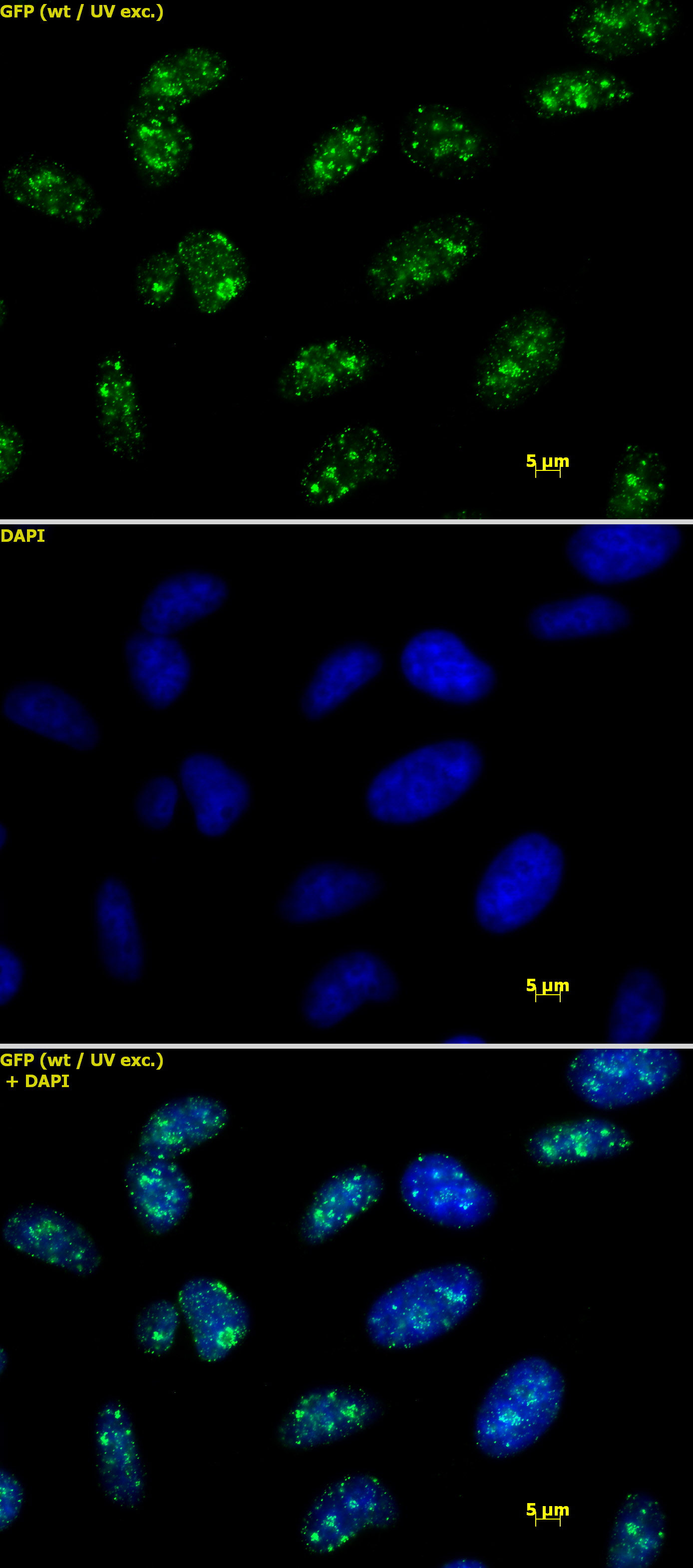 Histone H3 trimethyl Lys9 antibody tested by immunofluorescence. Detection of Histone H3 trimethyl Lys9 by immunofluorescence. HeLa cells were stained with Histone H3 trimethyl Lys9 antibody at a dilution of 1 ug/ml. Top panel: Histone H3 trimethyl Lys9 antibody staining. Middle panel: DAPI. Bottom panel: merge.