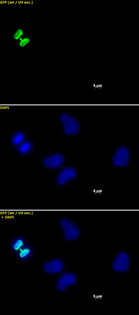 Histone H3 phospho Ser10 mAb tested by immunofluorescence. Staining of HeLa cells with Histone H3 phospho Ser10 mAb (1 ug/ml, top panel) and DAPI (middle panel), and a merge of both images (bottom panel).