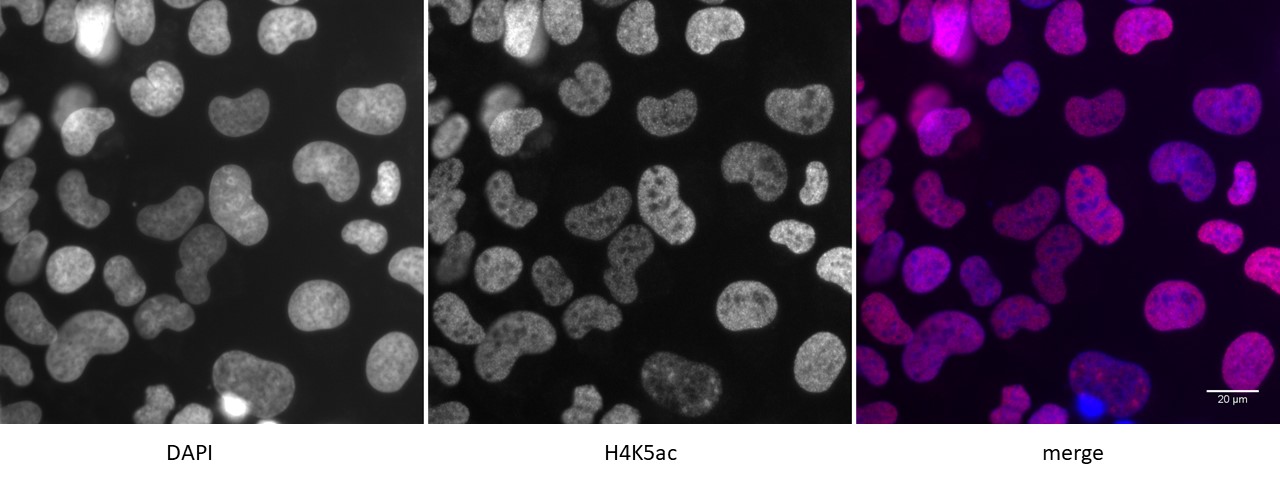 Detection of H4K5ac by immunofluorescence. U2OS cells were stained with H4K5ac antibody at a dilution of 1:500. Left panel: DAPI. Middle panel: H4K5ac antibody staining. Right panel: merge.