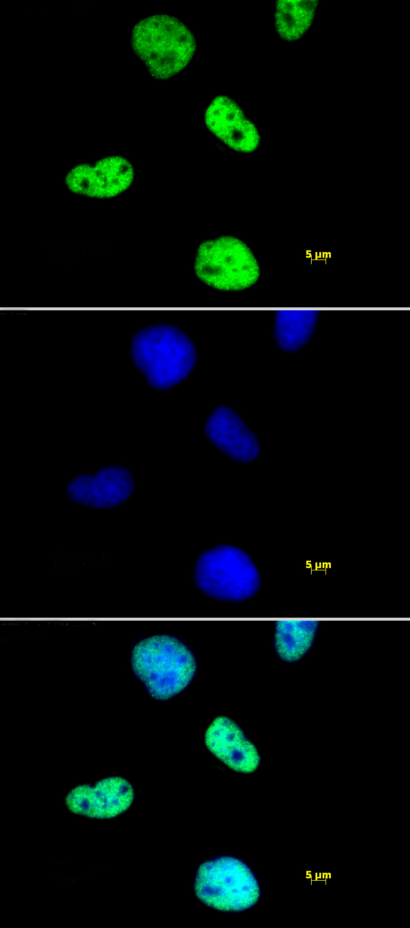 Histone H4 pan-acetyl antibody (pAb) tested by immunofluorescence. Staining of HeLa cells with Histone H4 pan-acetyl pAb (1:1,000 dilution, top panel) and DAPI (middle panel), and a merge of both images (bottom panel).