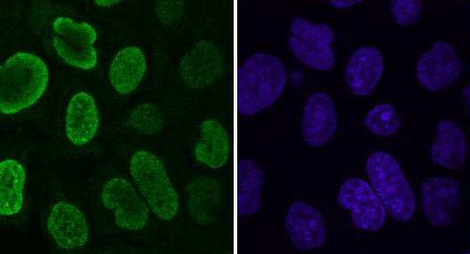 Histone macroH2A1.2 antibody (mAb) tested by immunofluorescence. Staining of macroH2A1.2 transfected HeLa cells with Histone macroH2A1.2 antibody (1:50 dilution, left panel) and DAPI (right panel).