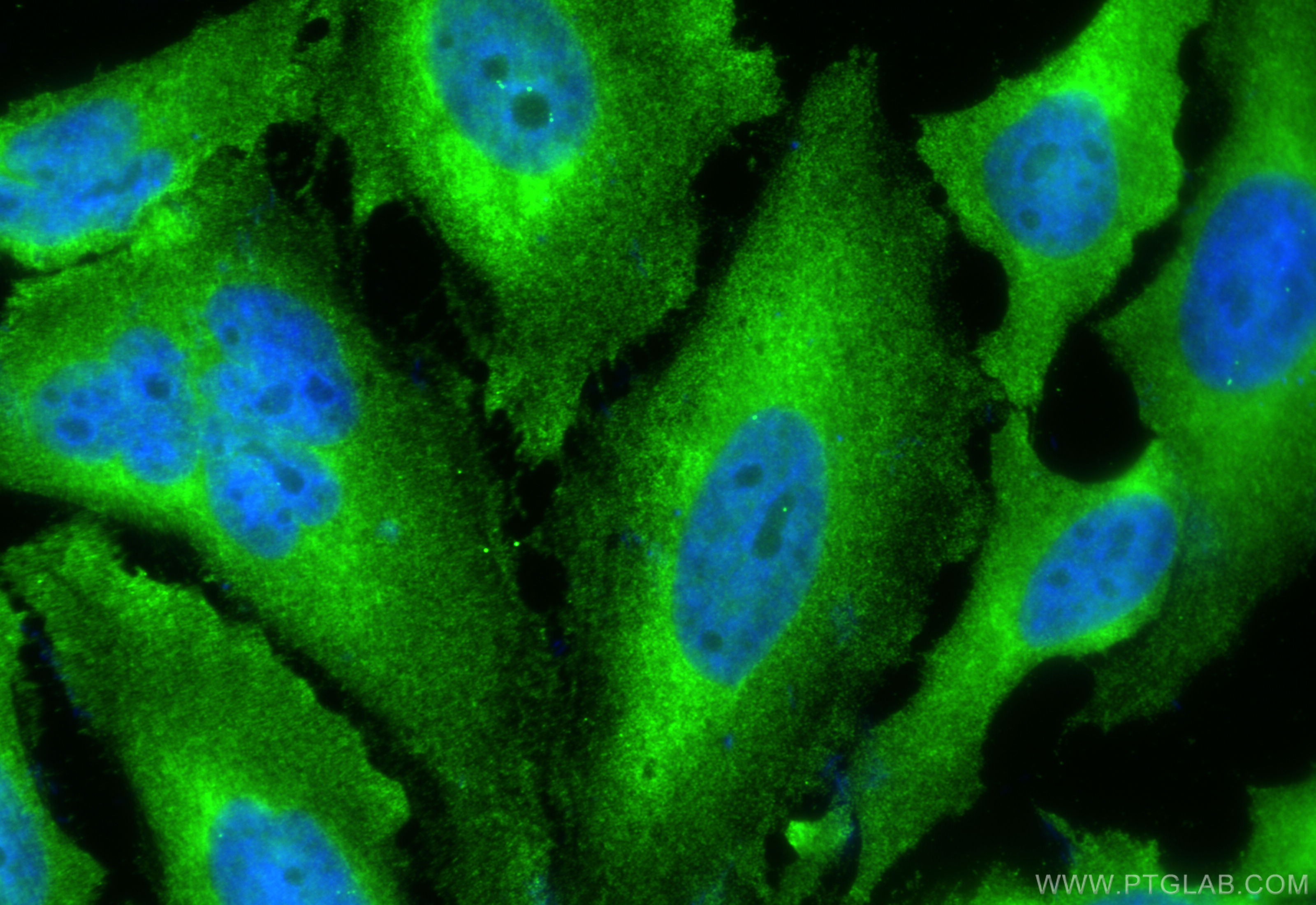 Immunofluorescence (IF) / fluorescent staining of HeLa cells using Hsc70 Monoclonal antibody (66442-1-Ig)