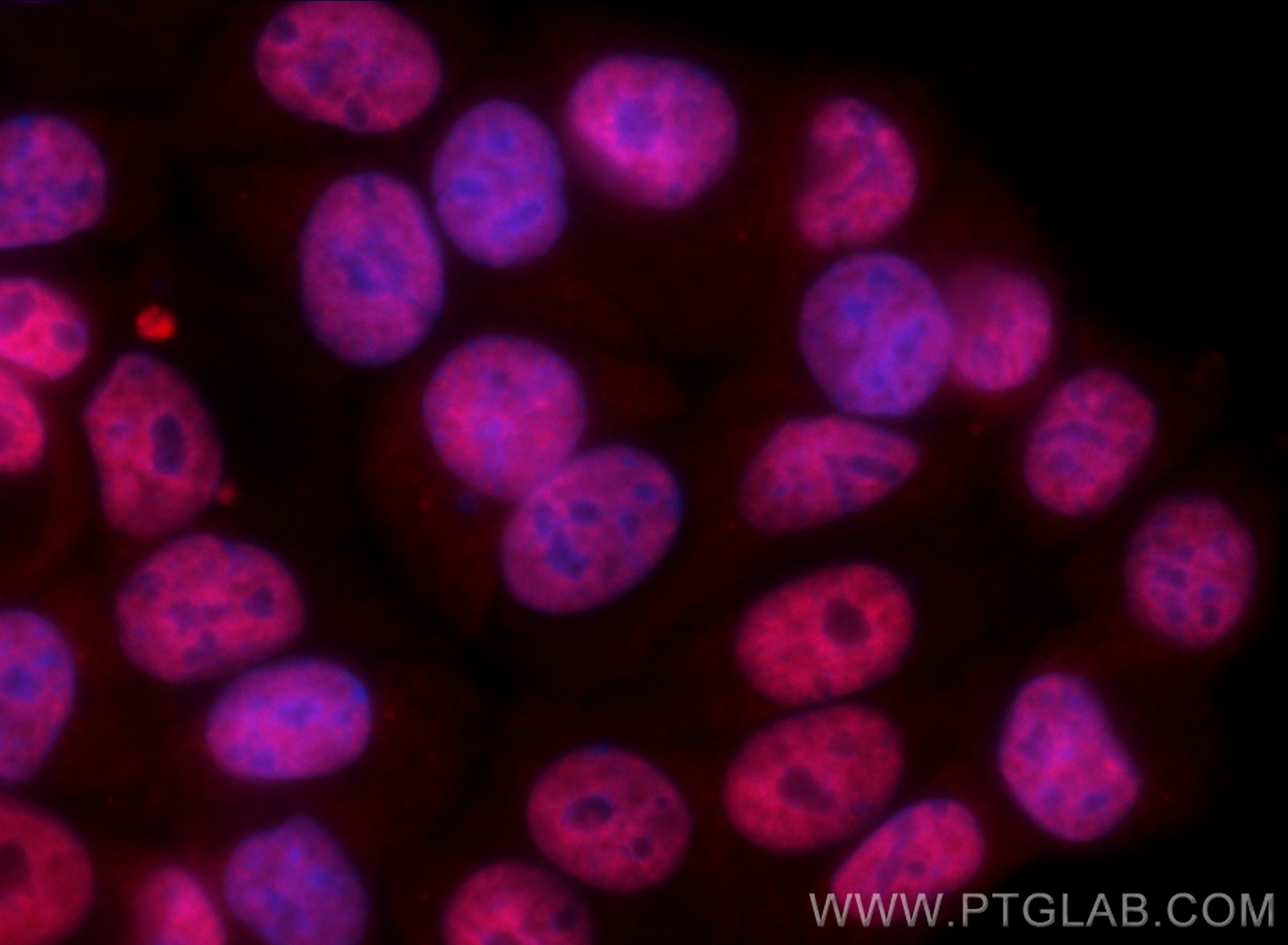 Immunofluorescence (IF) / fluorescent staining of MCF-7 cells using CoraLite®594-conjugated HuR/ELAVL1 Polyclonal anti (CL594-11910)