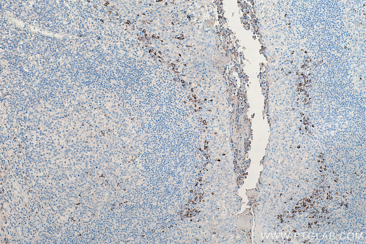 Immunohistochemistry (IHC) staining of human tonsillitis tissue using Human IgG Kappa chain Monoclonal antibody (67761-1-Ig)