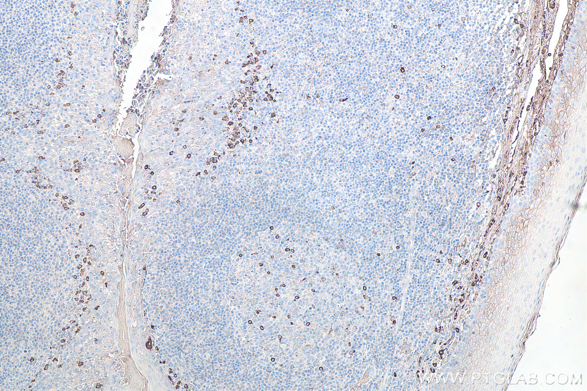 Immunohistochemistry (IHC) staining of human tonsillitis tissue using Human IgG lambda chain Monoclonal antibody (67762-1-Ig)